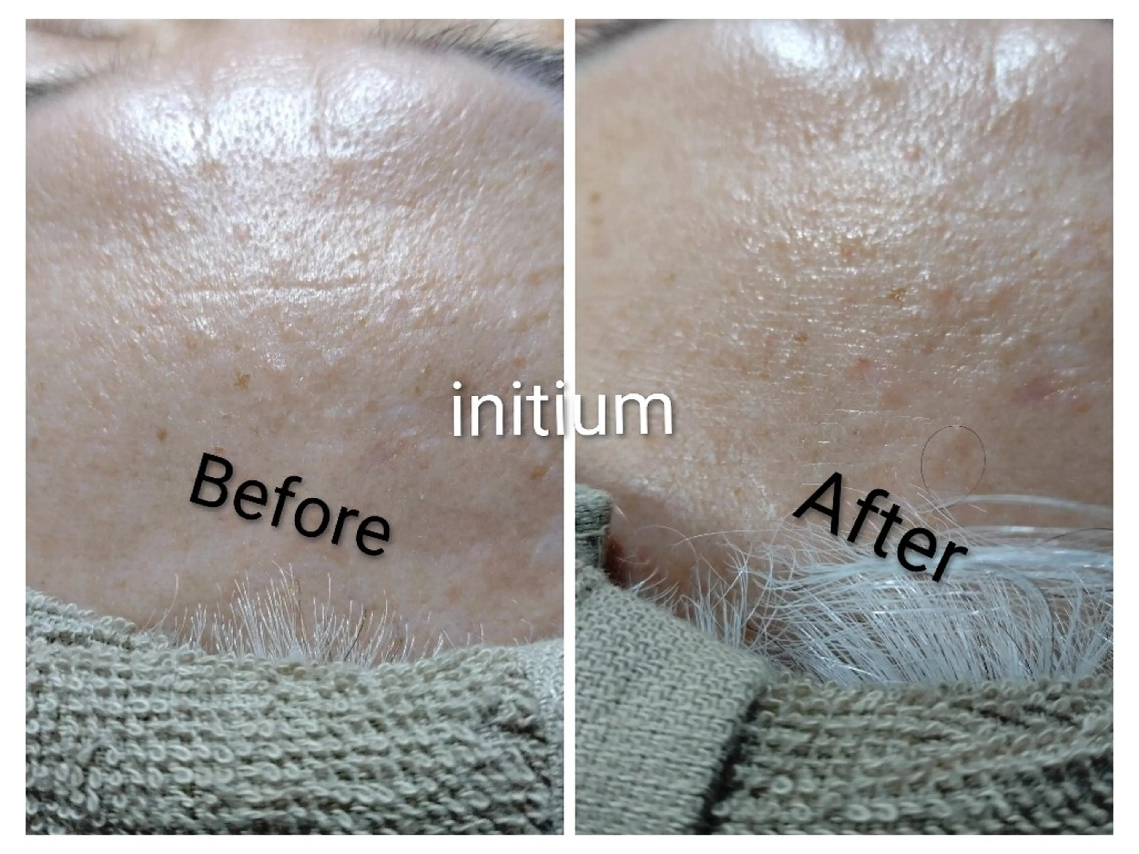 清澄白河 initiumのエステ・リラクイメージ