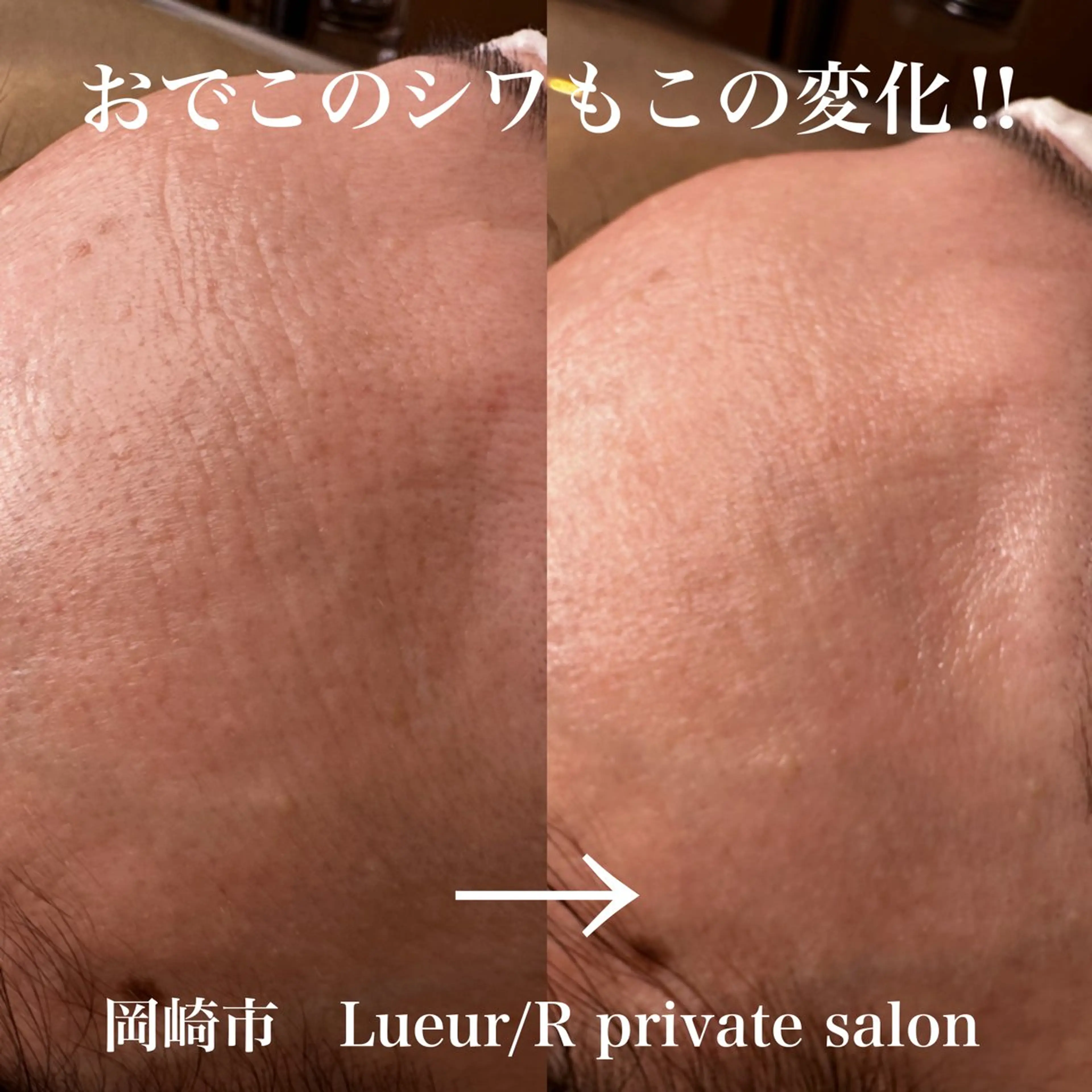 その他 大久保 里奈のエステ・リラクイメージ