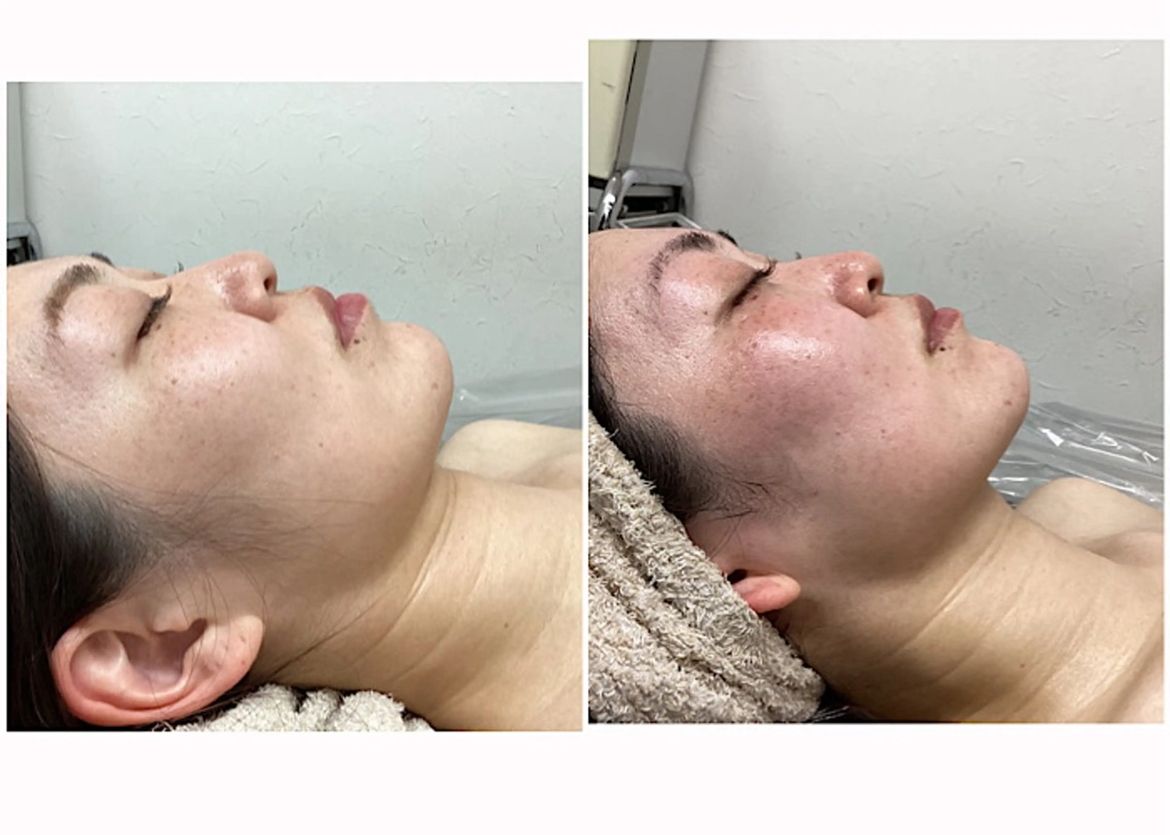 ize 横浜店のエステ・リラクイメージ