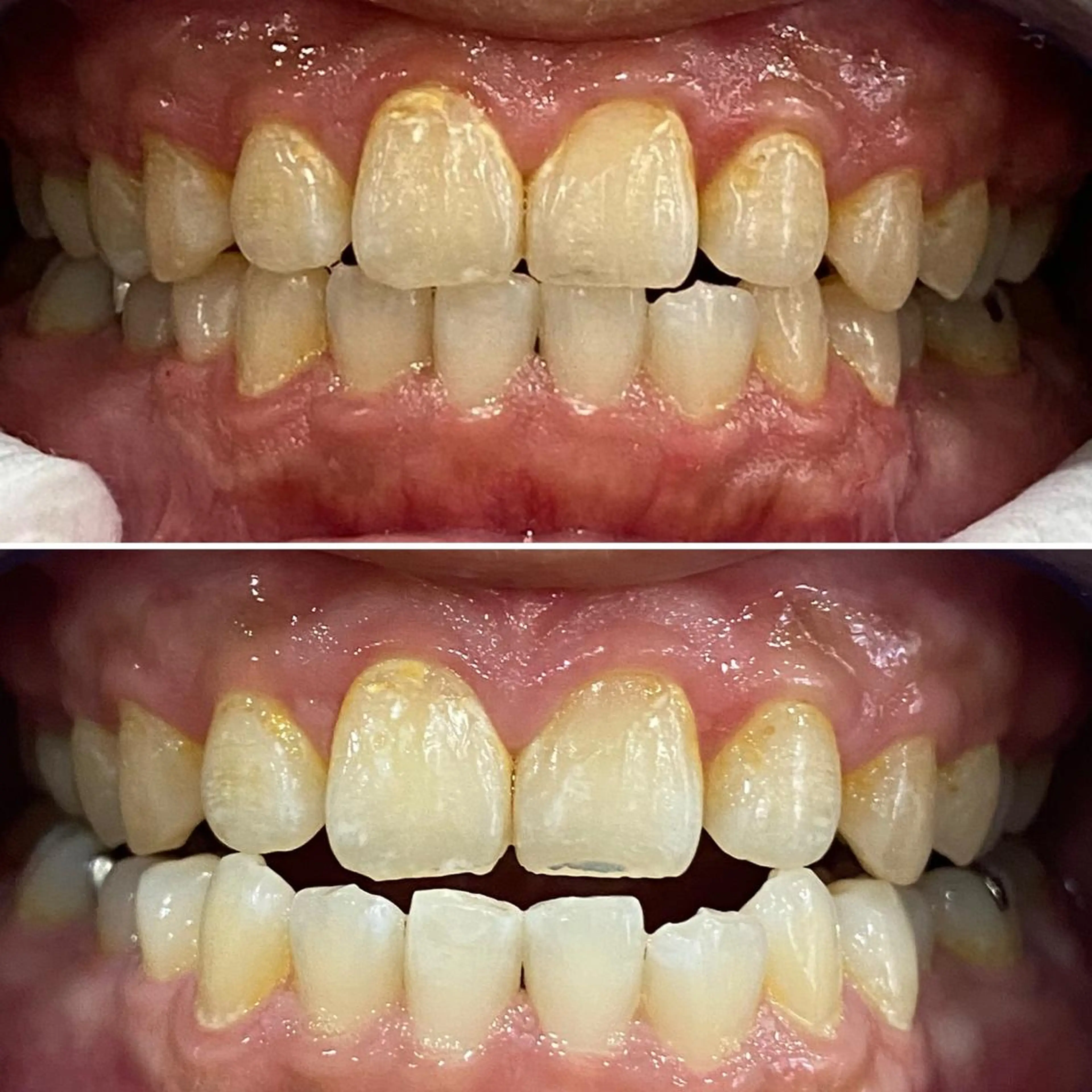 その他 whiteclub THREEのその他イメージ