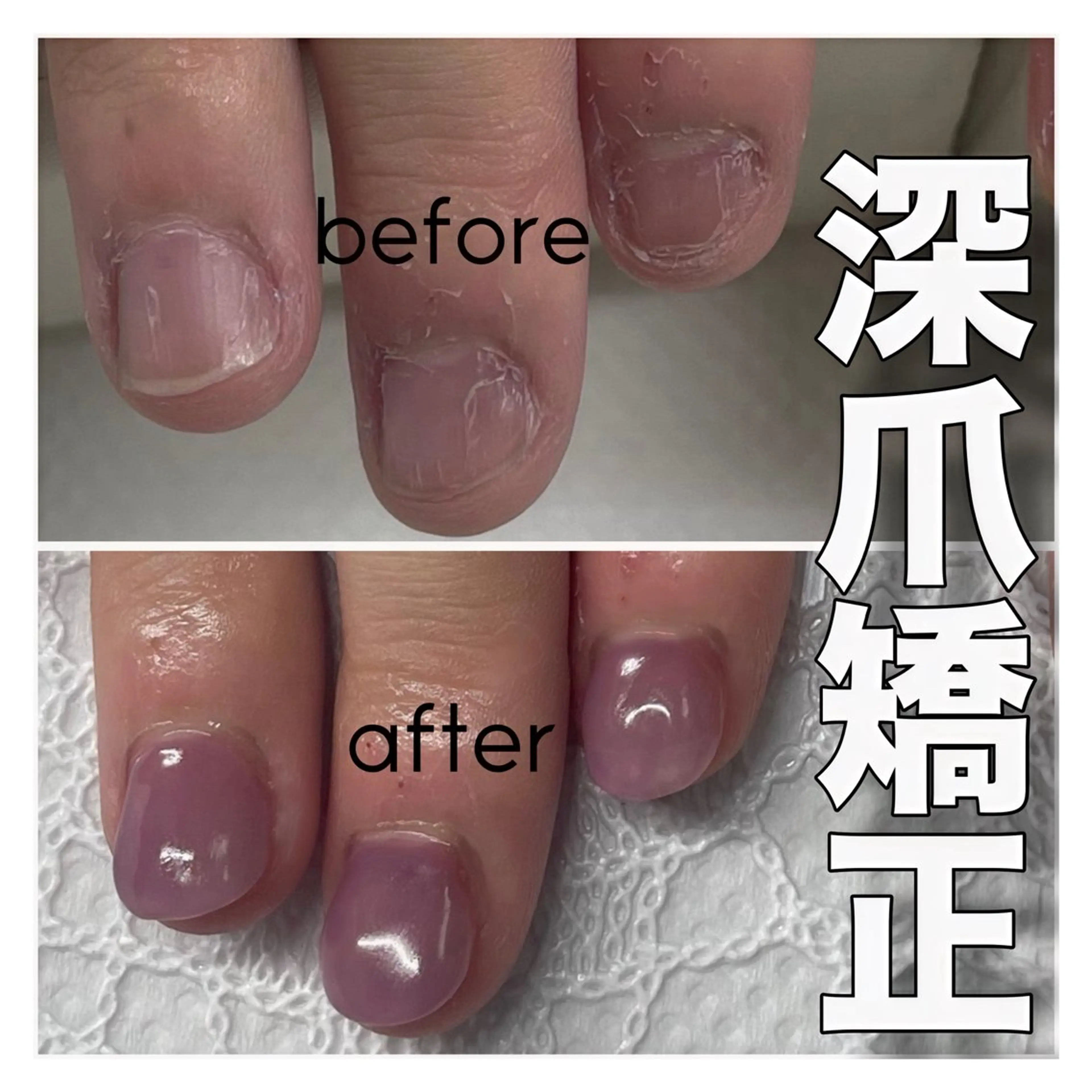ネイル 長さ出し ハンドネイル ハンドケア nail salon petillantのネイルデザイン