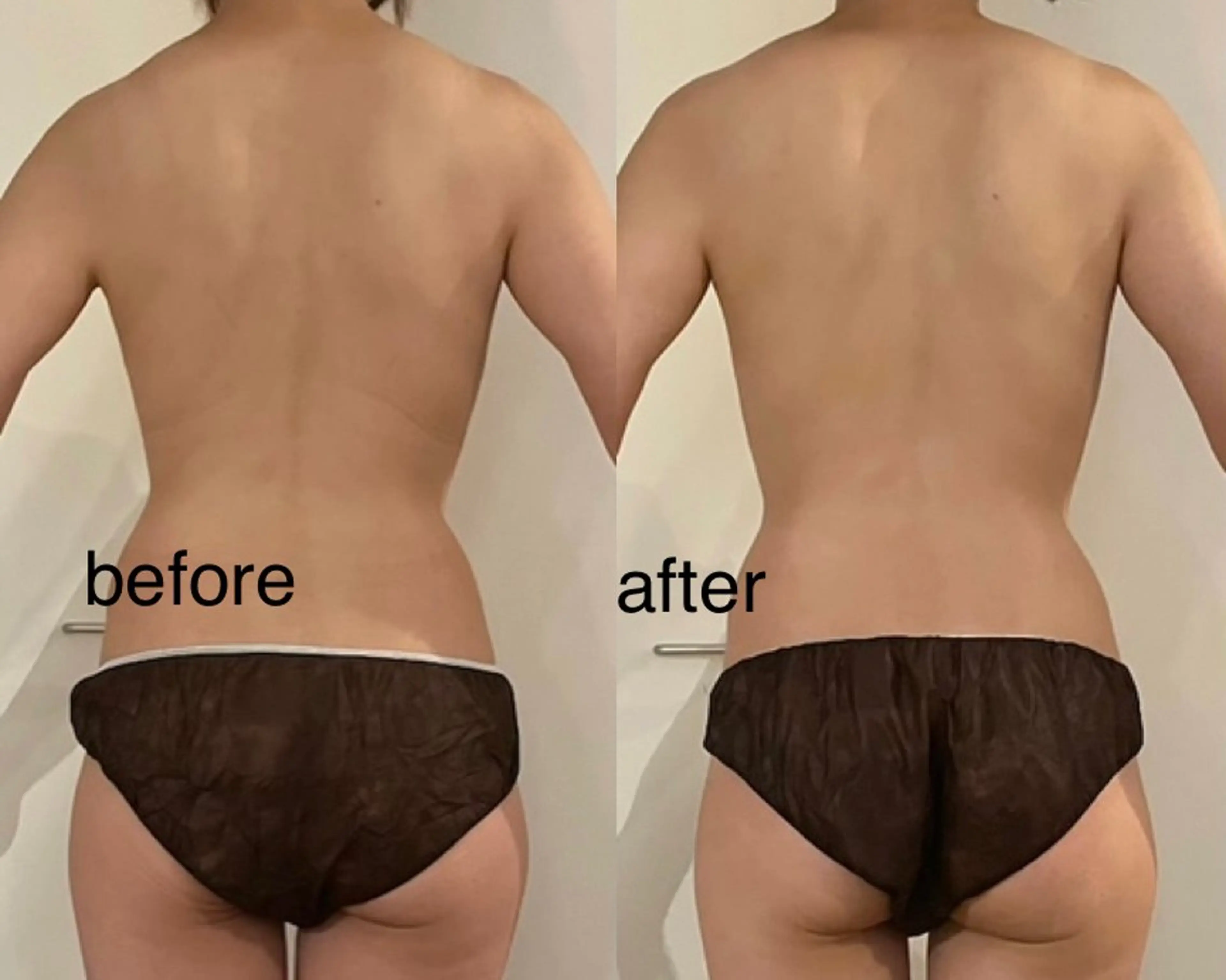 エステ リラク プライベートサロン シュシュのエステ・リラクイメージ