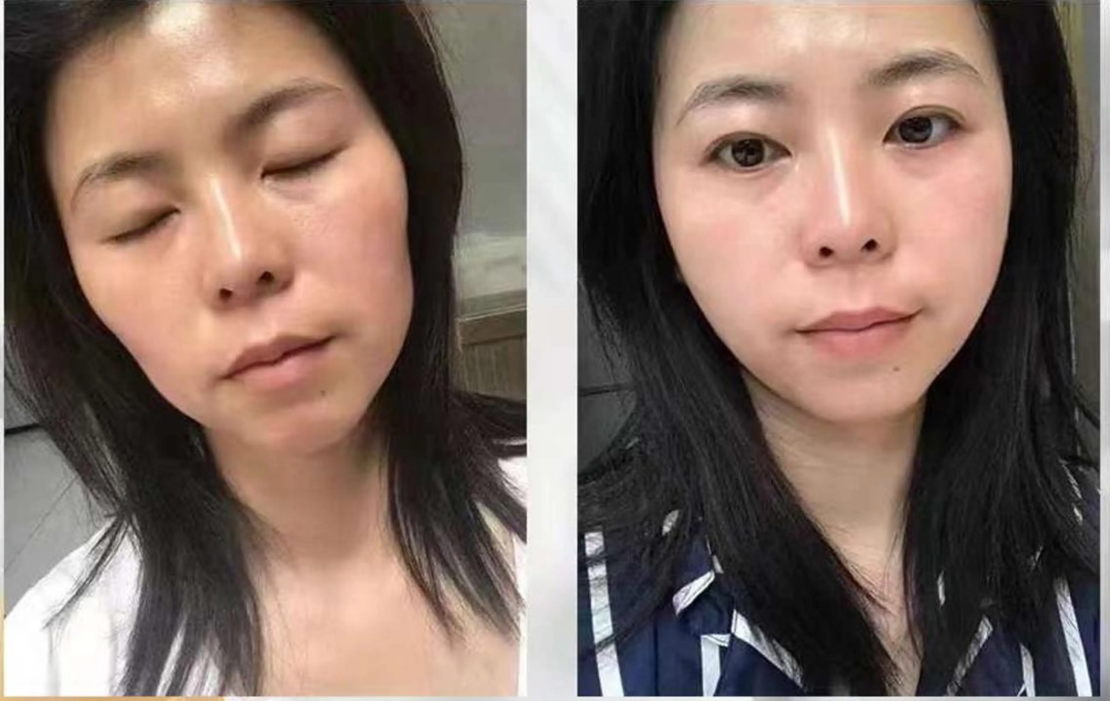 エステ aliaハーブ水光店 エステティシャン募集のエステ・リラクイメージ