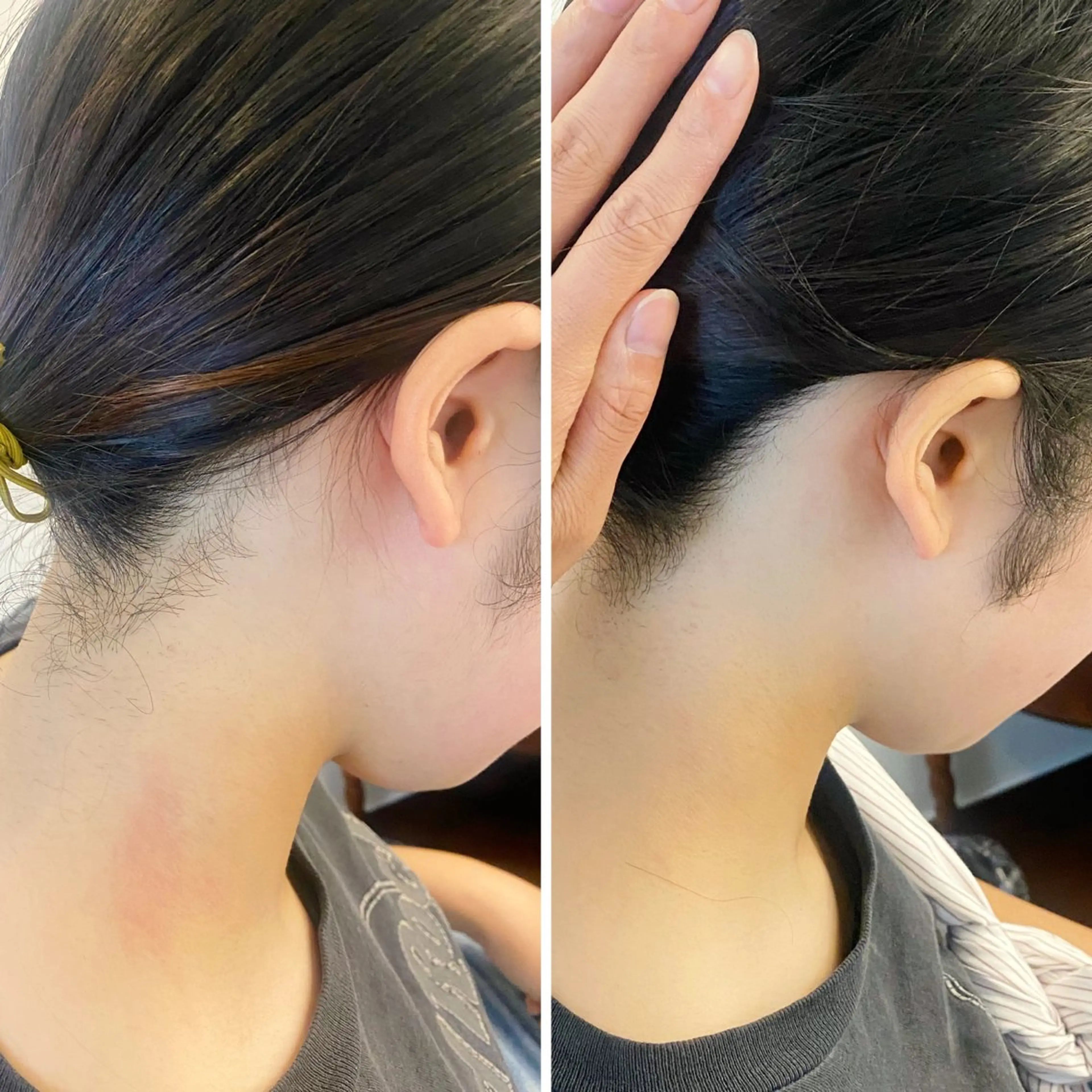 脱毛 うなじ脱毛/美肌脱毛 LABELのエステ・リラクイメージ