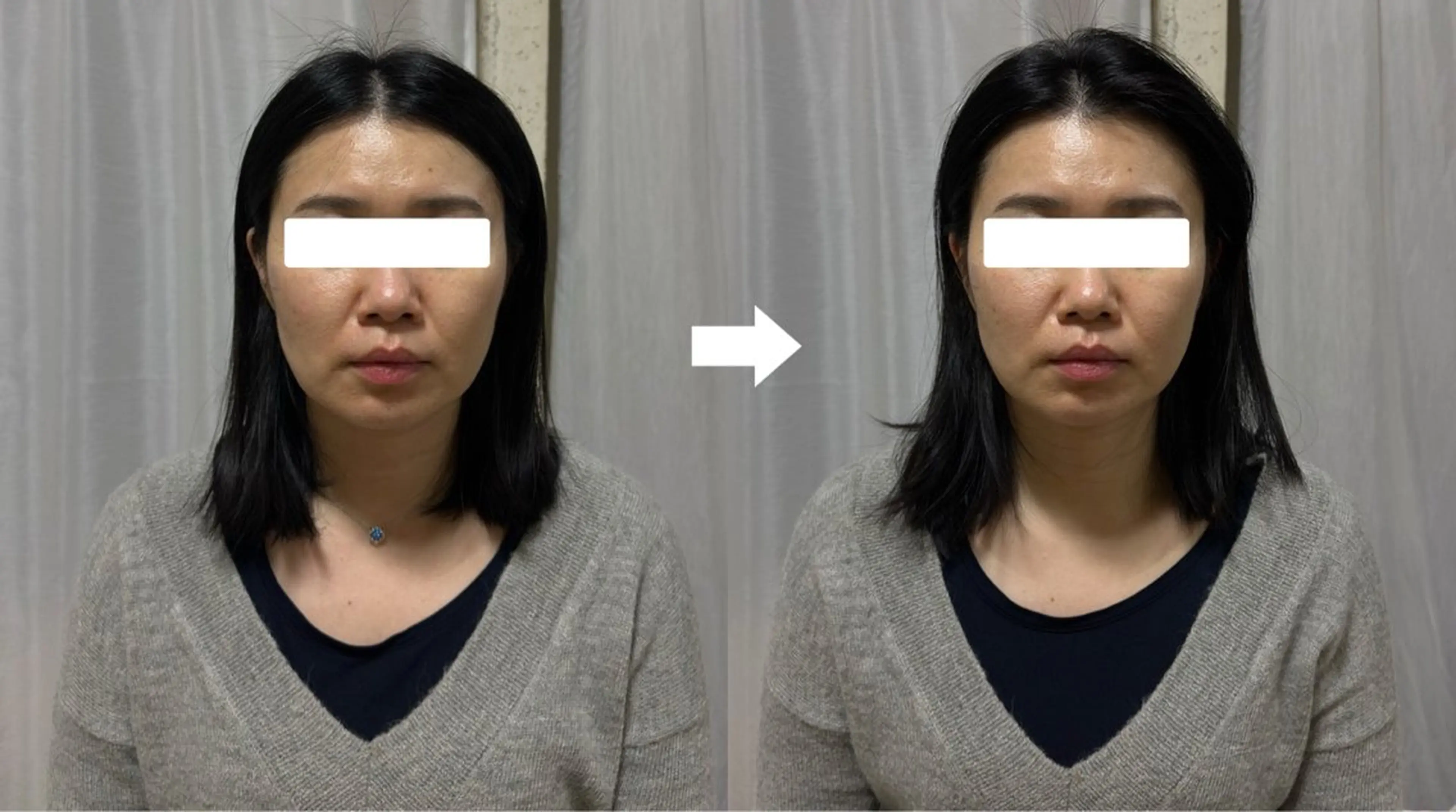 リラク fots. 愛美のエステ・リラクイメージ