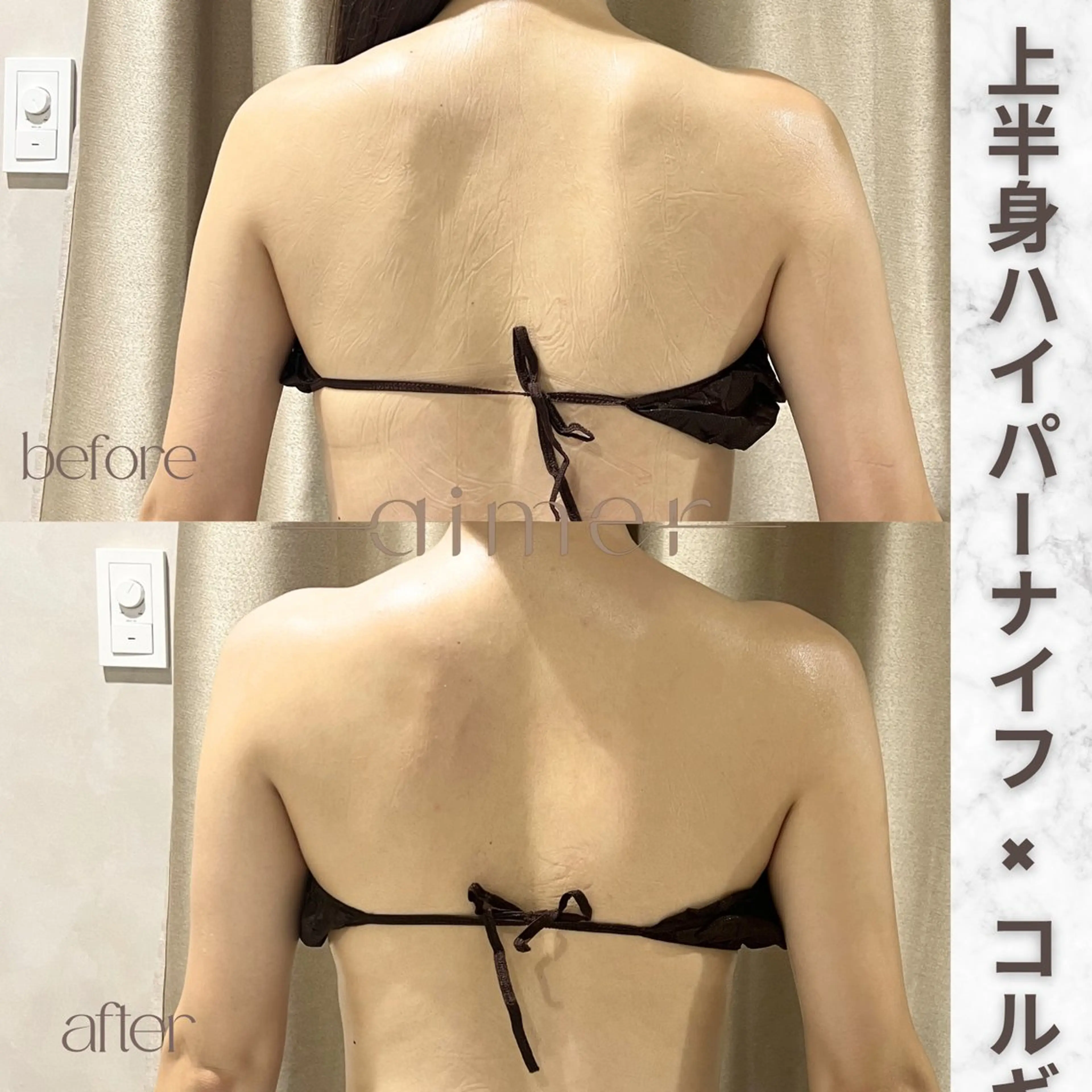 aimer服部 /  小顔 ・ 痩身のその他イメージ
