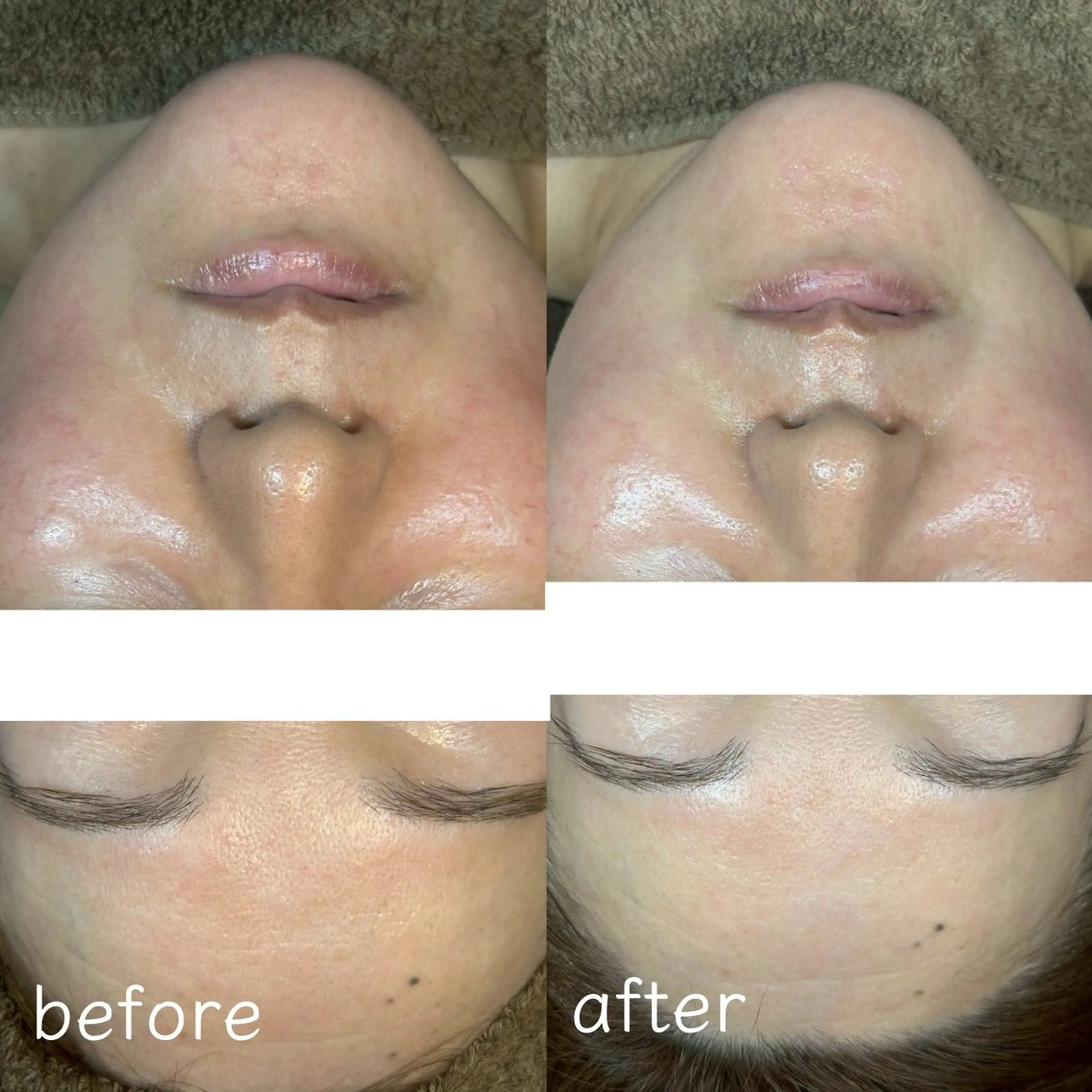 エステ 長野 美里のエステ・リラクイメージ