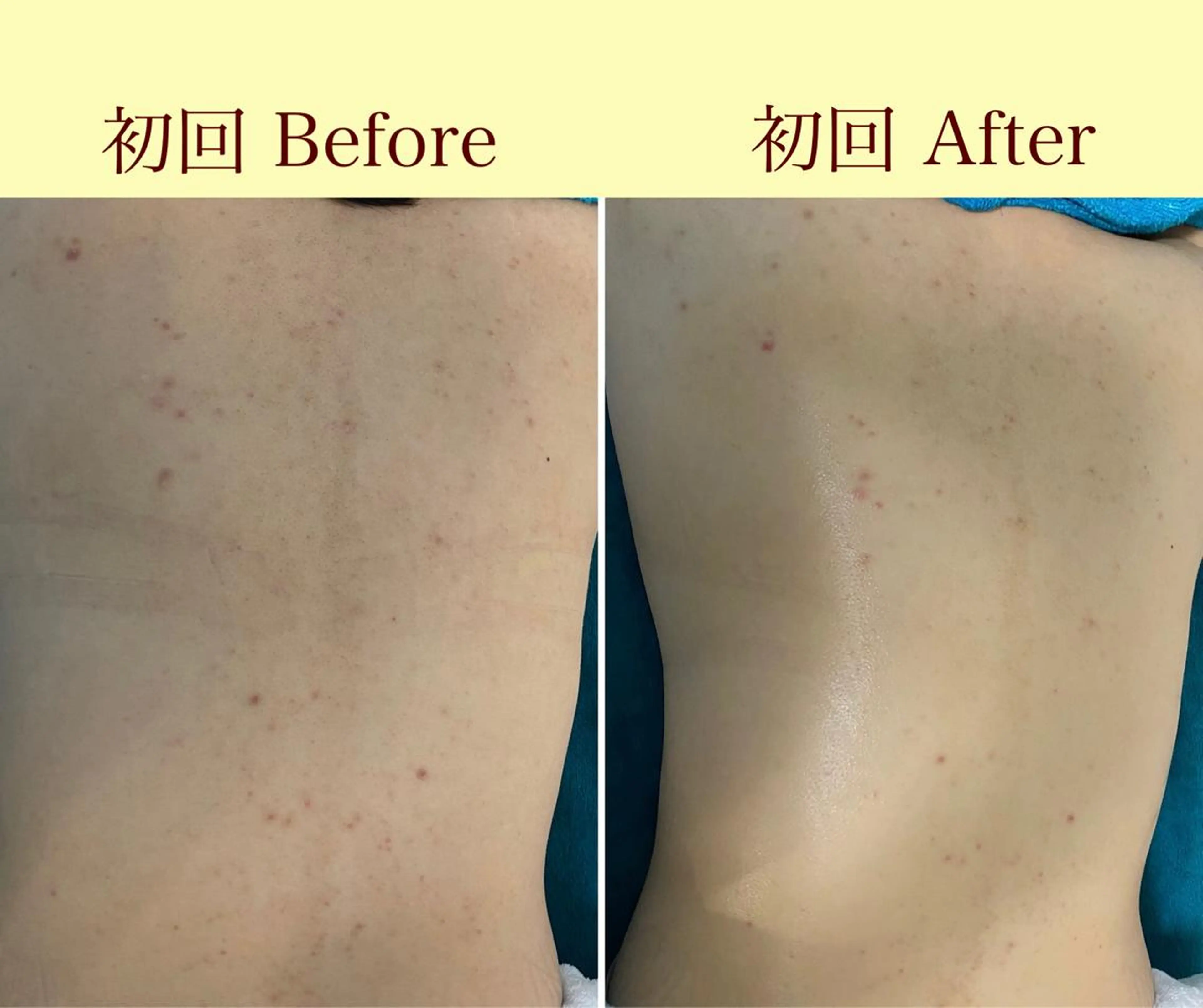 メンズ歓迎🙆‍♀️ エステ/ネイルISTのネイルデザイン