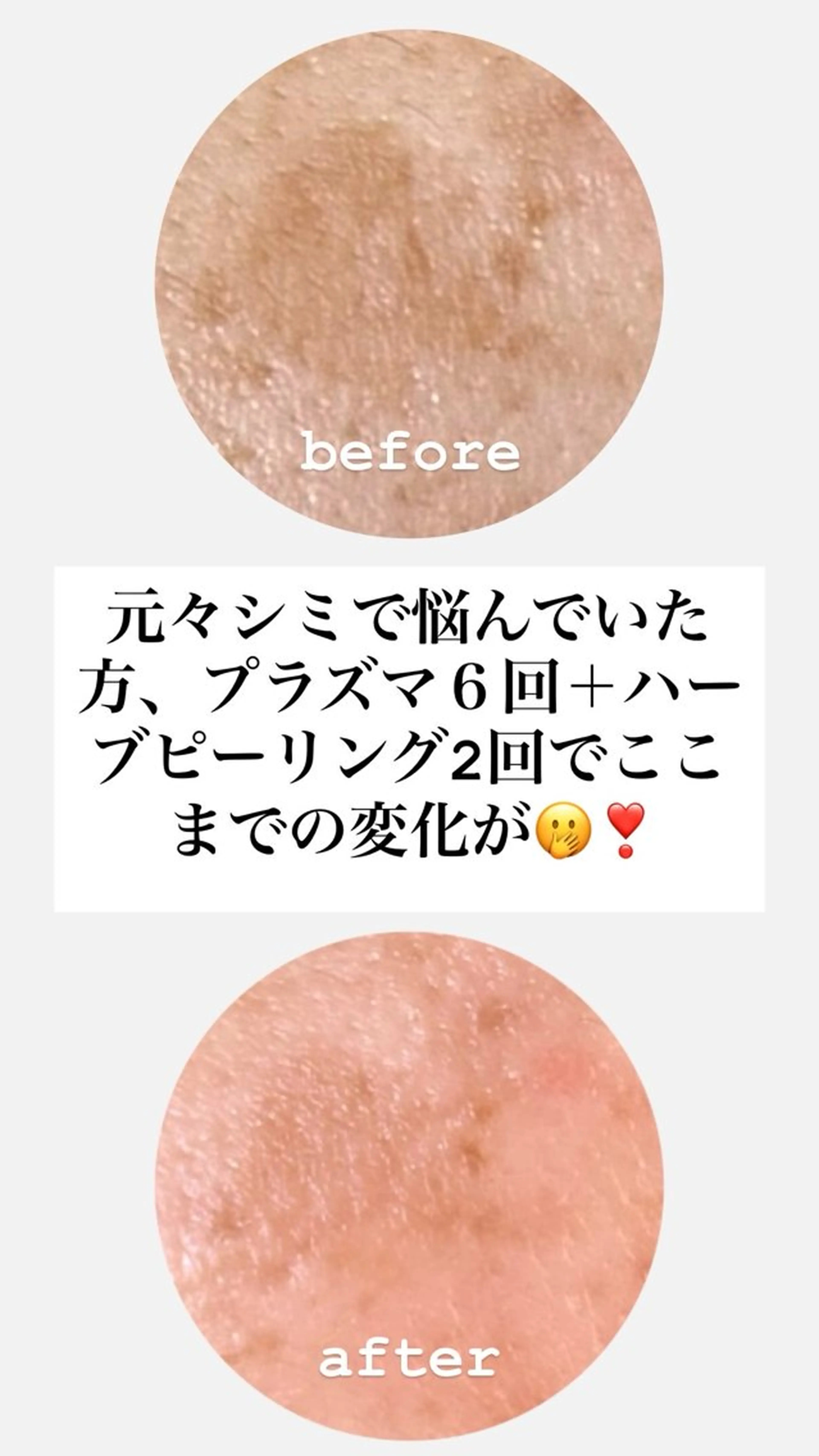 Rairy Salon富士見町のエステ・リラクイメージ