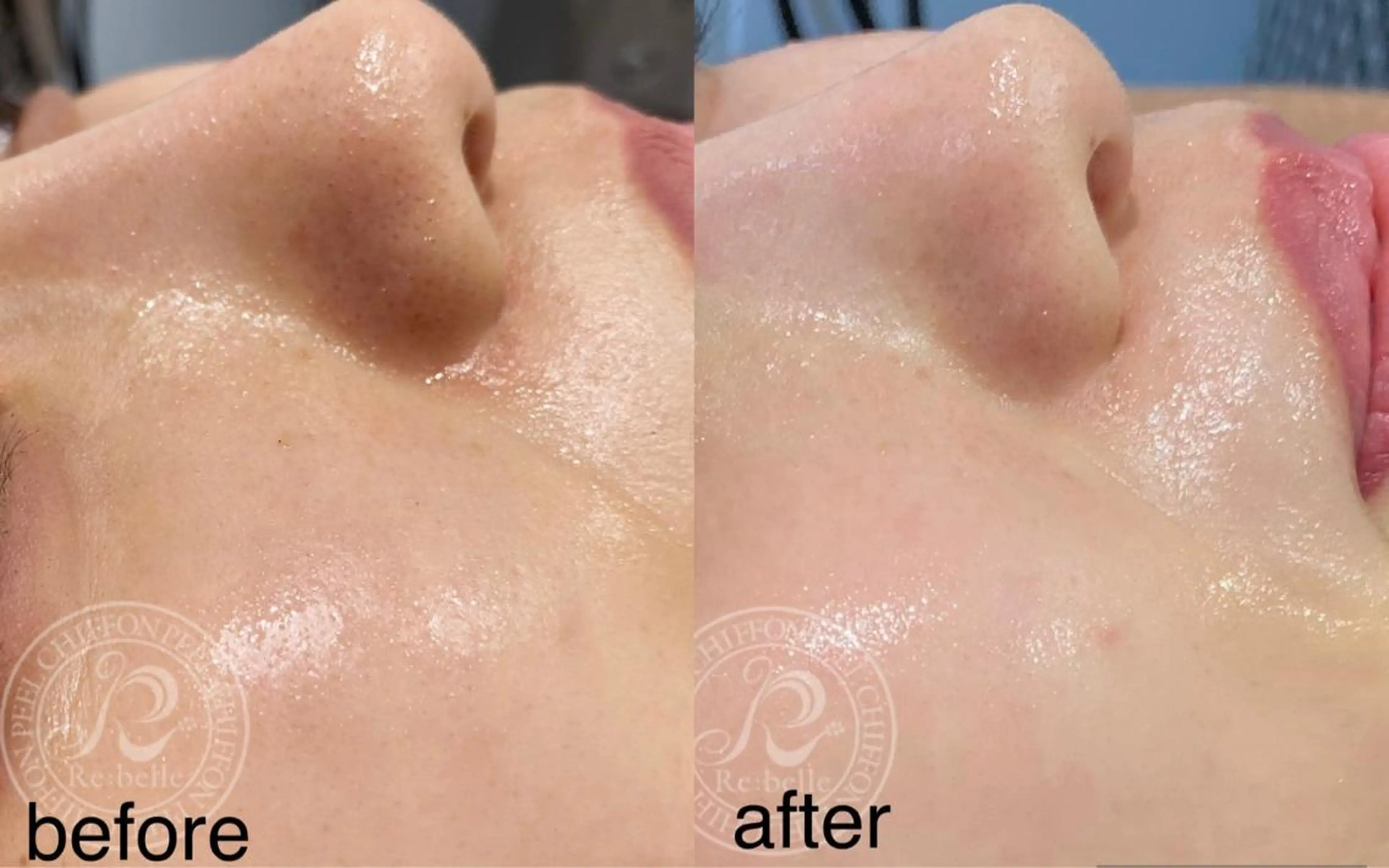 エステ Lavi&所属・肌質改善サロン Lavi&のその他イメージ