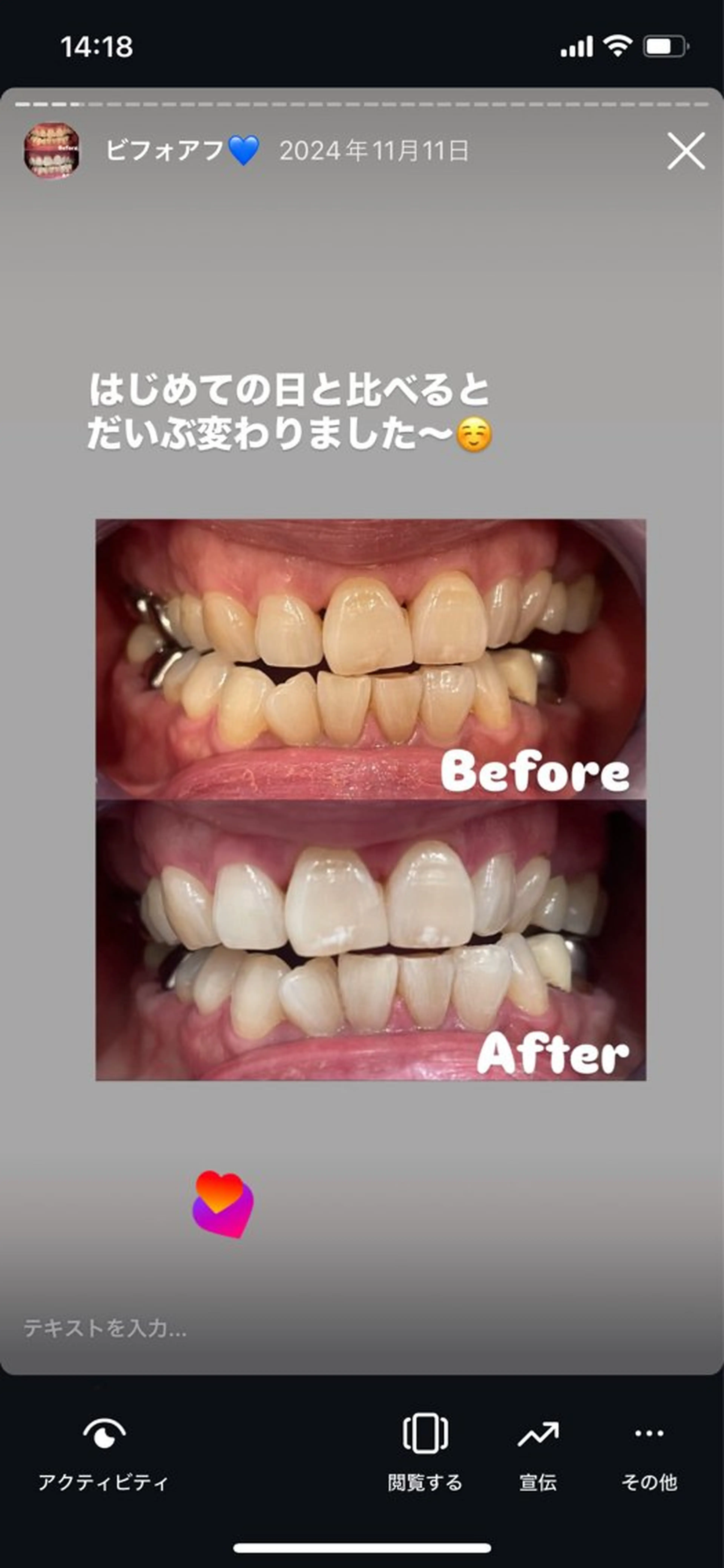 Kaula ホワイトニング🦷✨のエステ・リラクイメージ