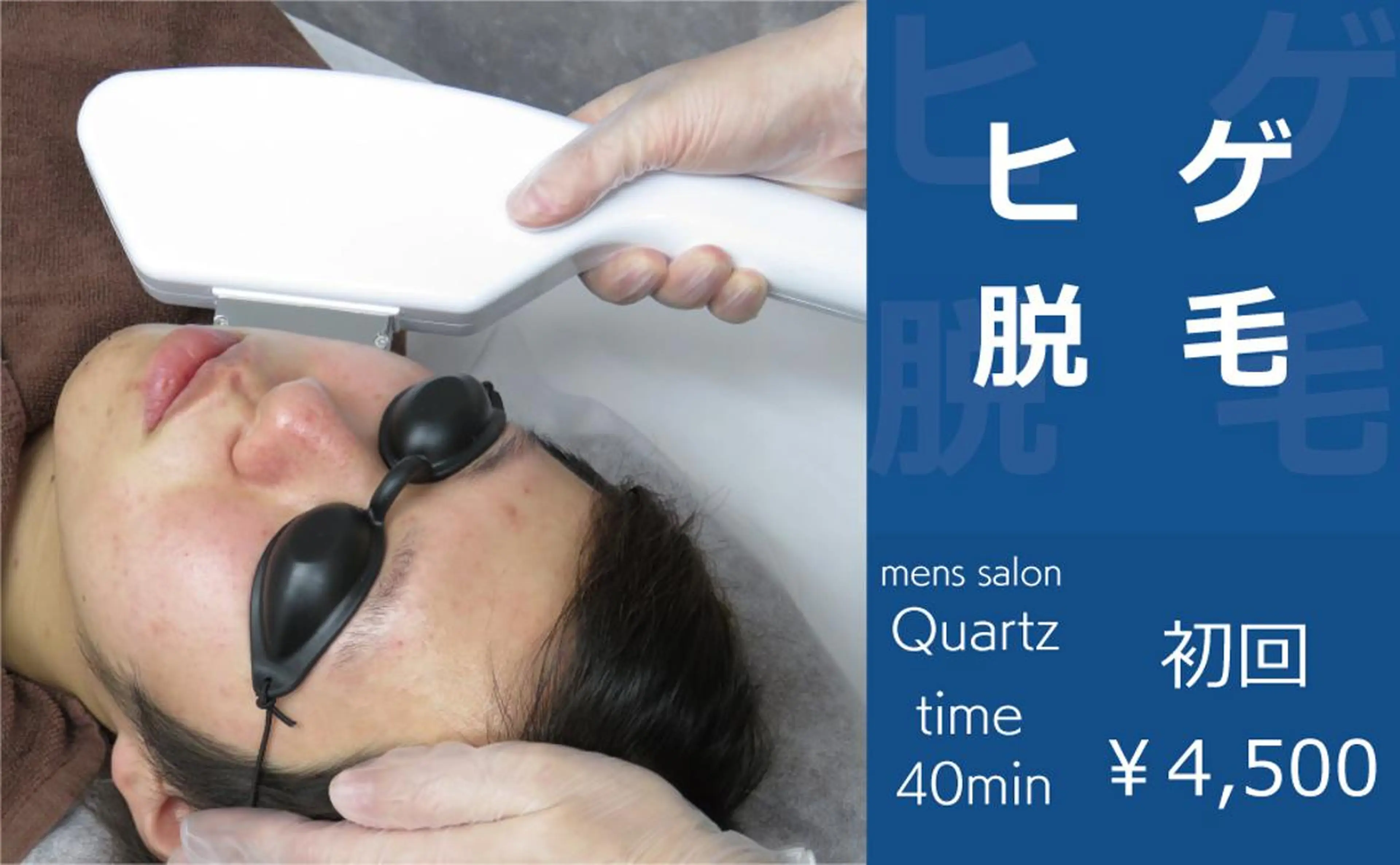 【minimo限定】初回　メンズ　ヒゲ脱毛（パック付）の写真