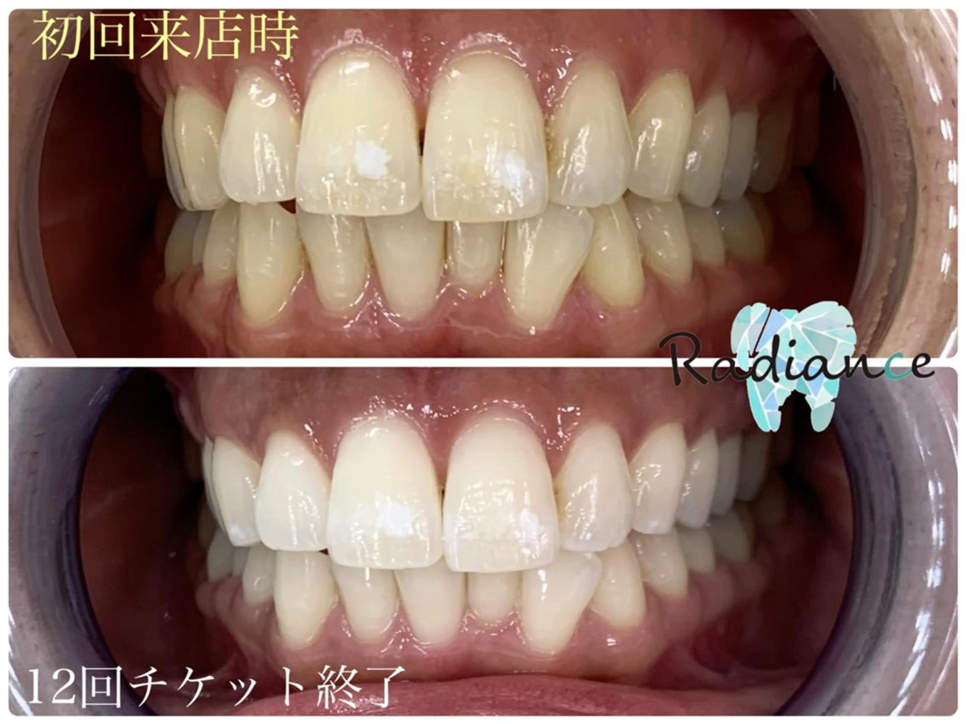 札幌ホワイトニング ラディアンス菊水店のその他イメージ