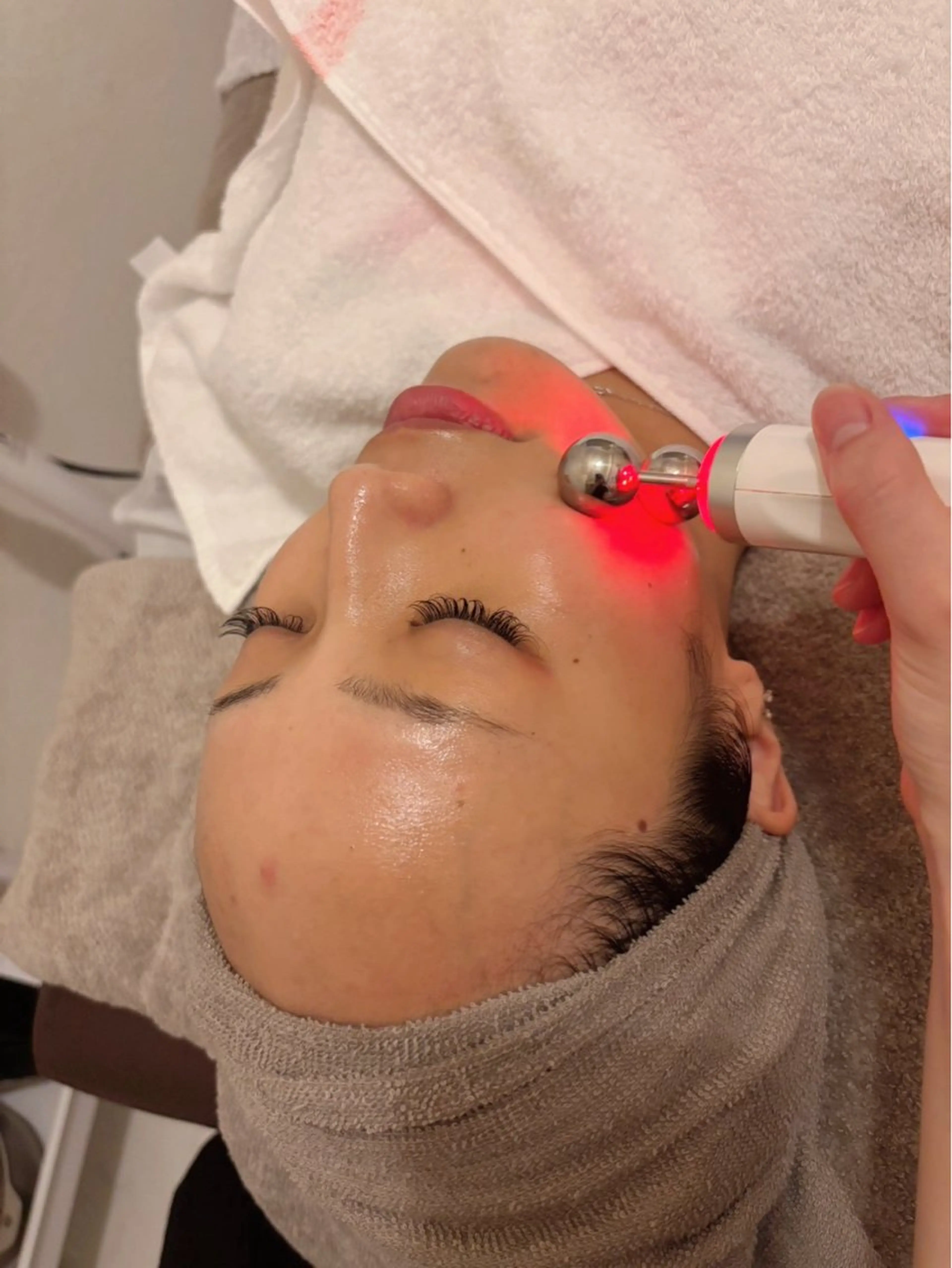 【乾燥・花粉に負けない肌へ✊🏻】毛穴洗浄＋ヒト幹細胞美容液導入💜（ニキビ/フェイシャル）の写真