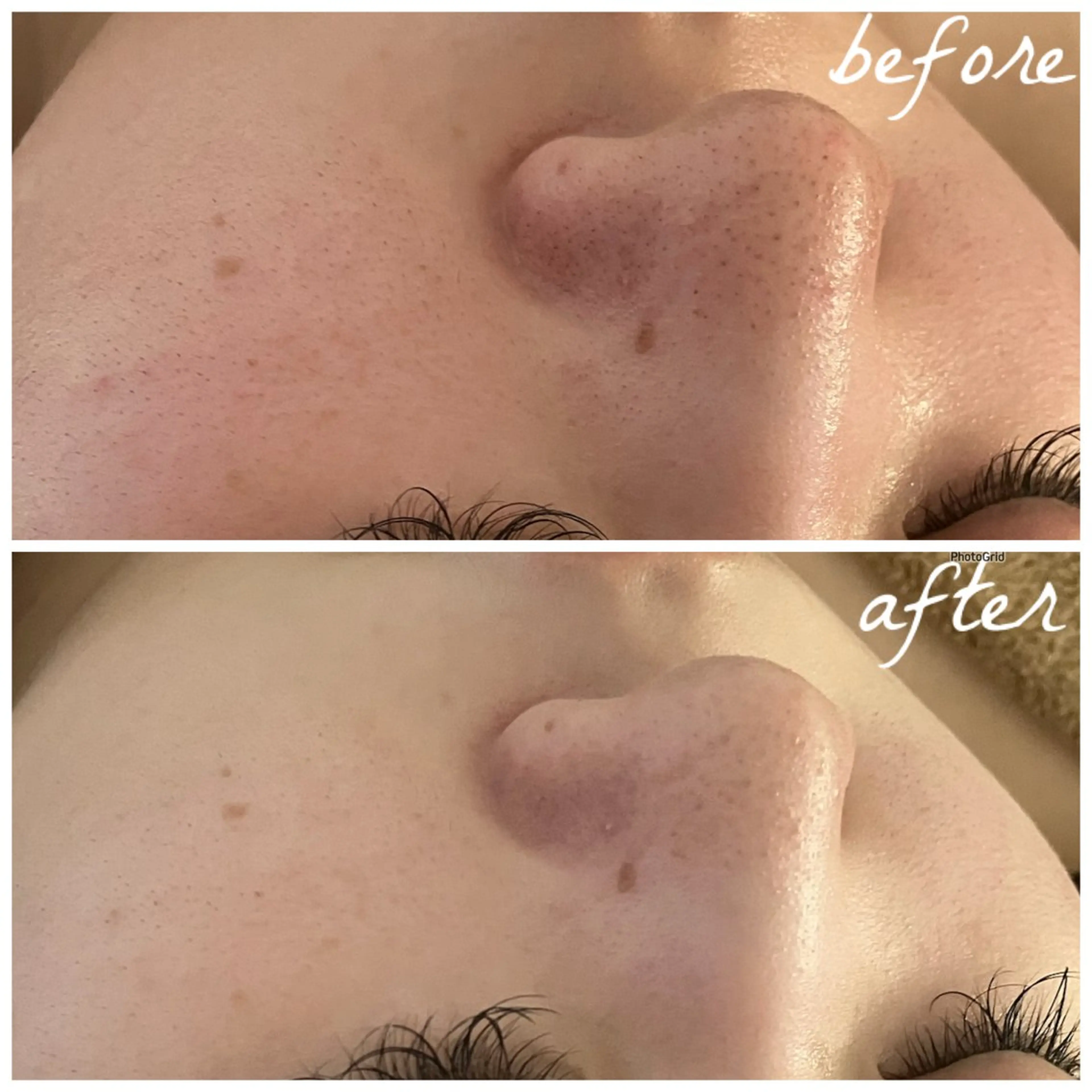 メンズ エステ メナード岐阜茜部 杉浦のエステ・リラクイメージ