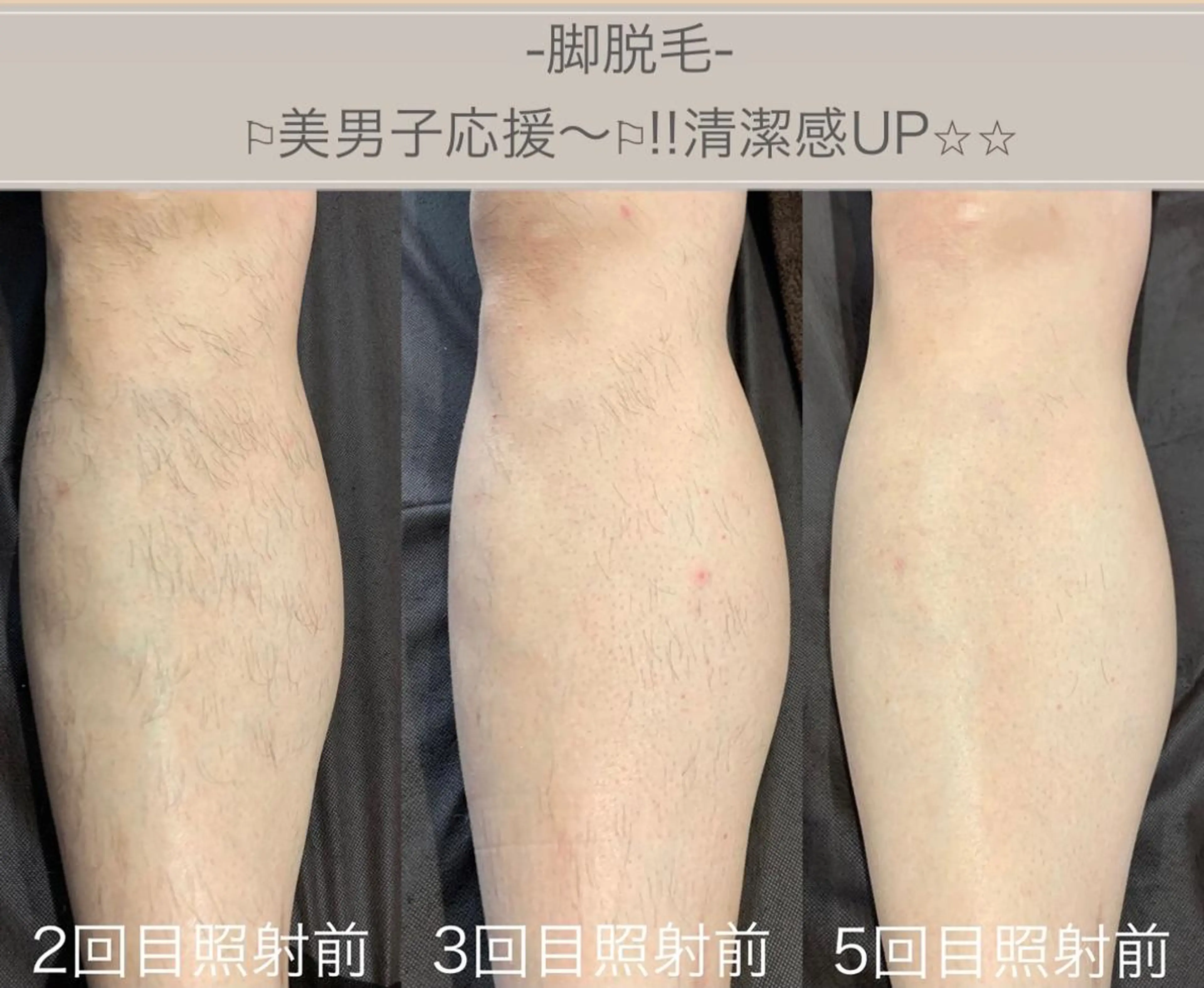 メンズ 脱毛&ビューティー A'nJUDYの眉毛・アイブロウイメージ