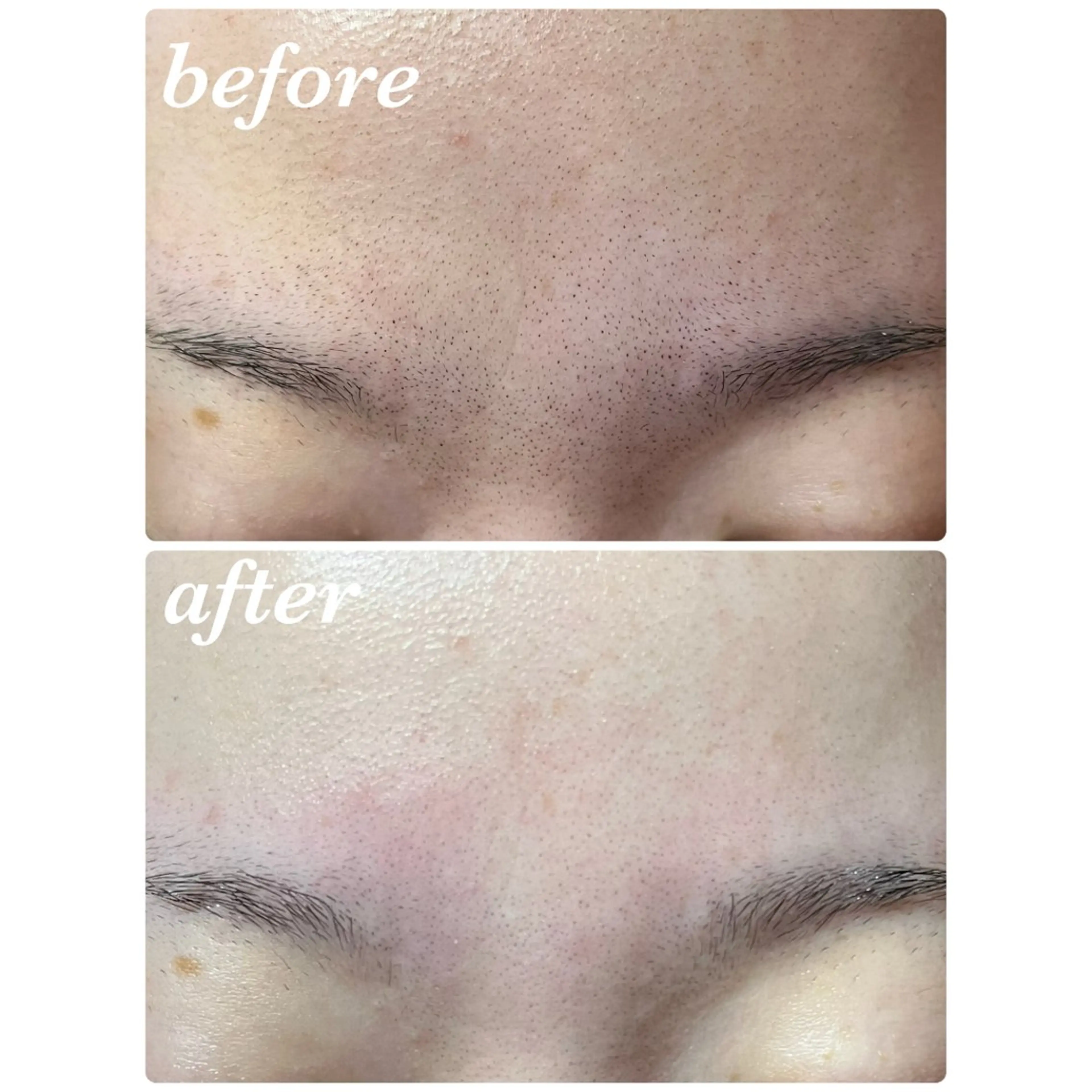 結果重視｜毛穴エステ ｜友綱理恵のエステ・リラクイメージ