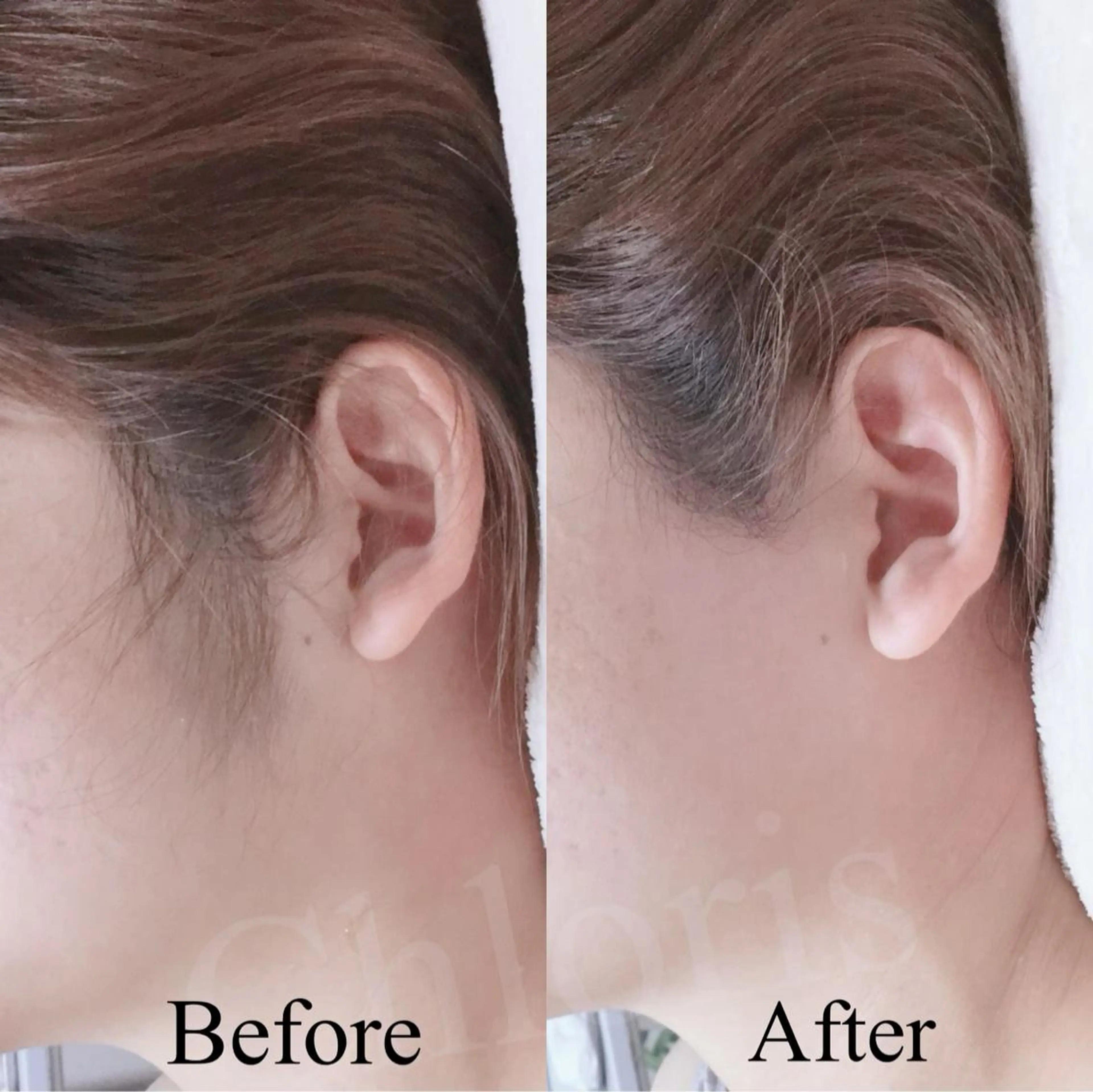 川越デリケートゾーン 光脱毛/ワックス脱毛のエステ・リラクイメージ