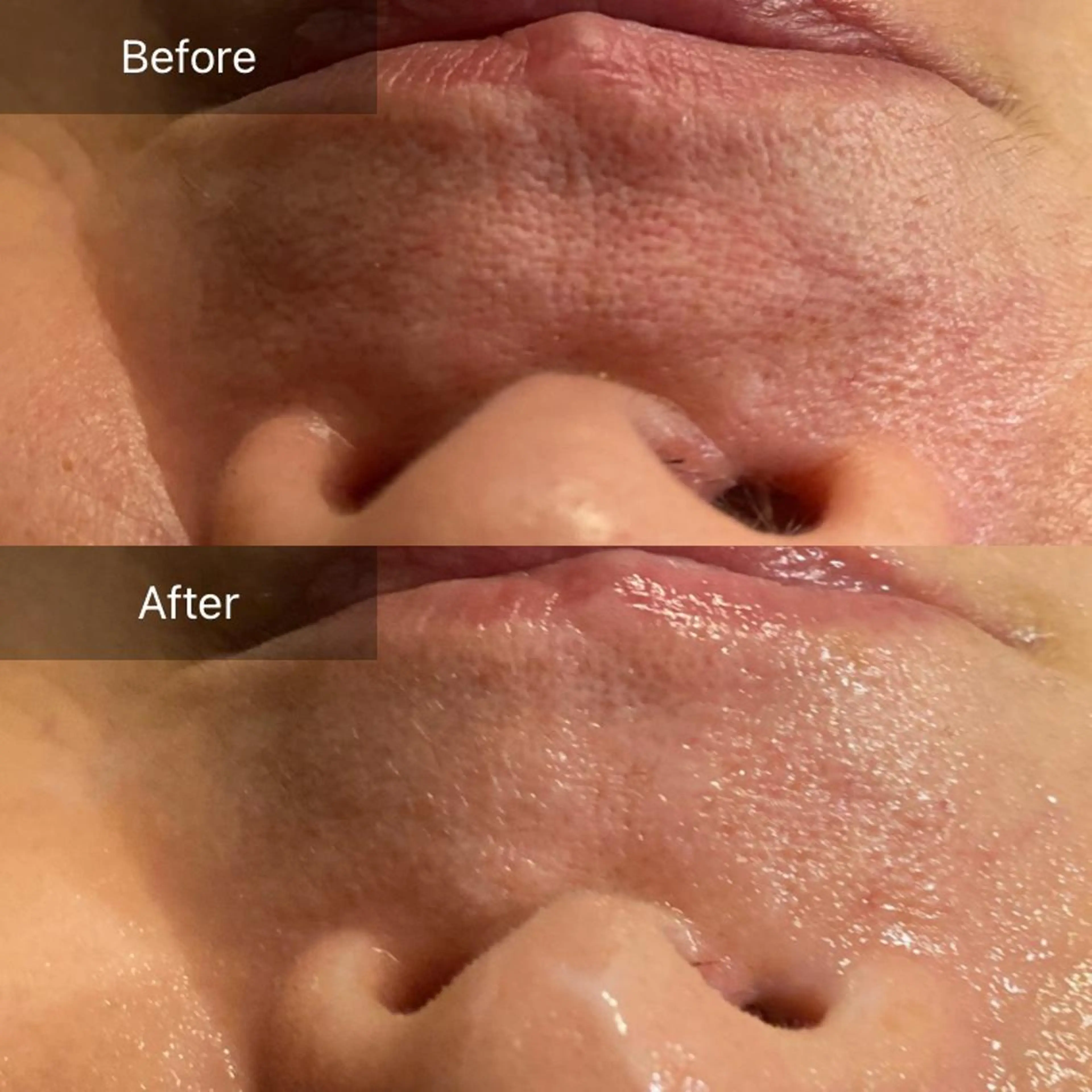 Mandarin Orange所属・毛穴から始める肌メン テマンダリンオレンジのエステ・リラクイメージ