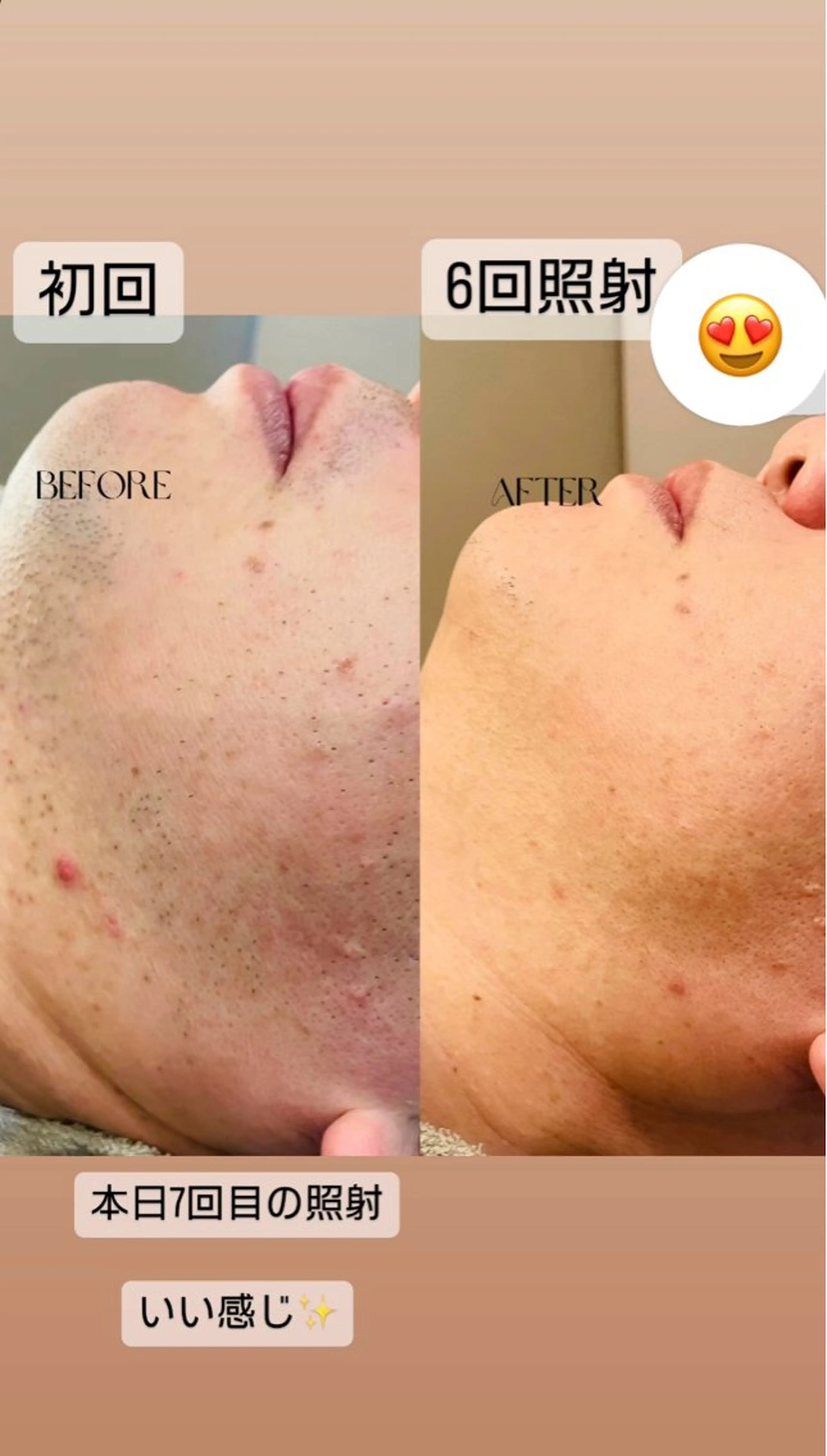 メンズ 脱毛 脱毛＆リラク FIS福岡薬院店のエステ・リラクイメージ