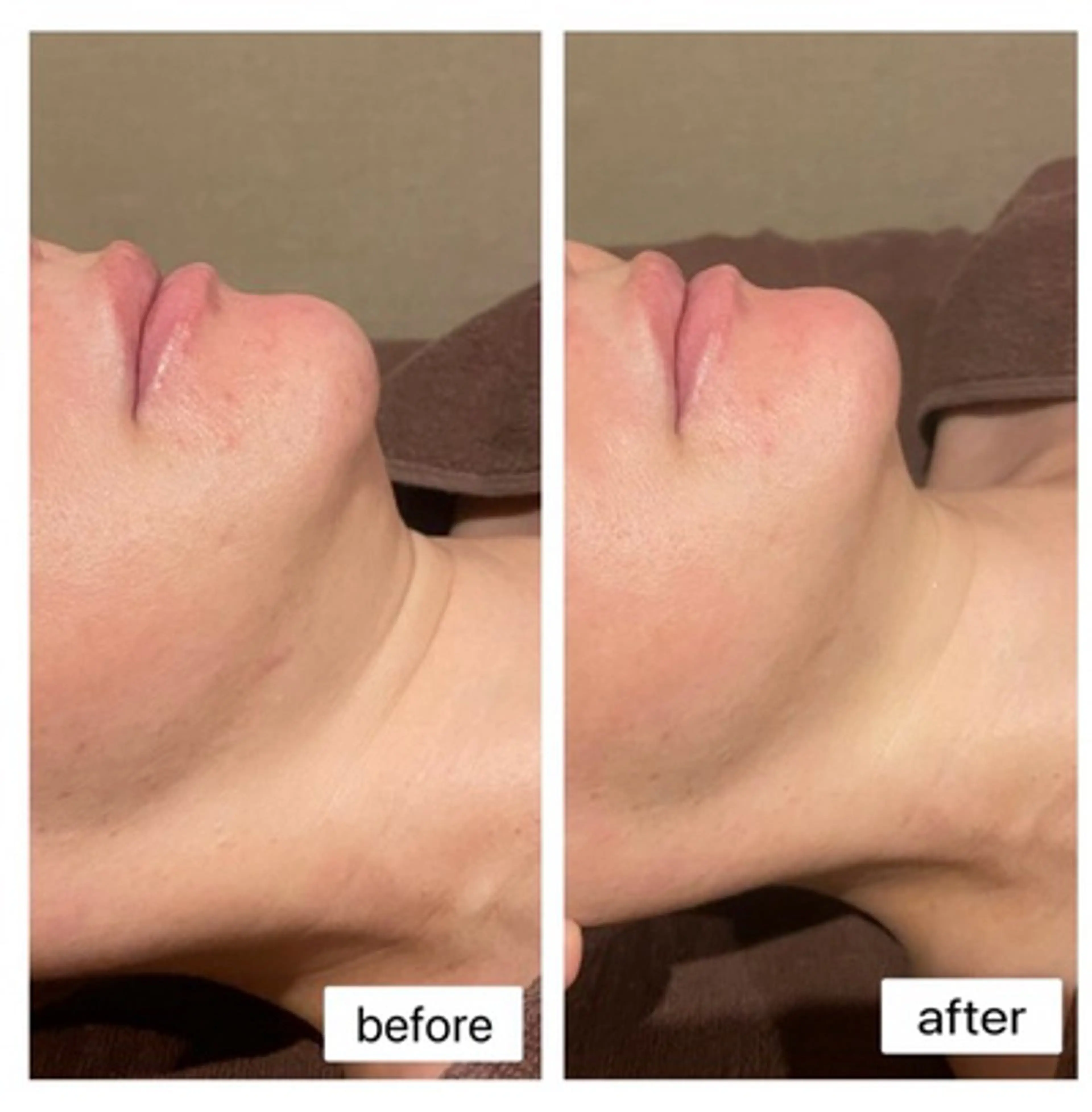 エステ ResetLab 佐藤 風香のエステ・リラクイメージ