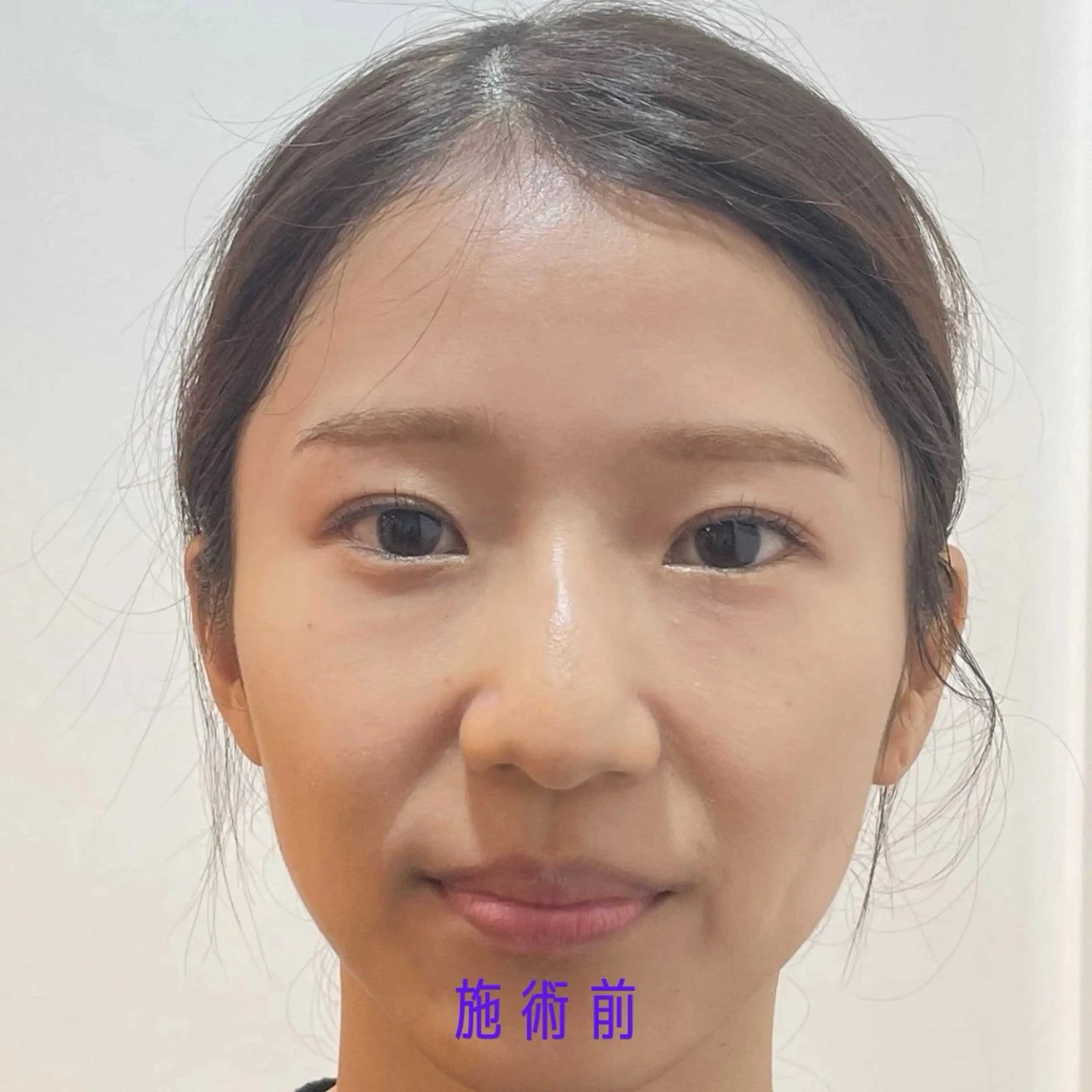 エステ Nexfit for Beauty小顔矯正のエステ・リラクイメージ