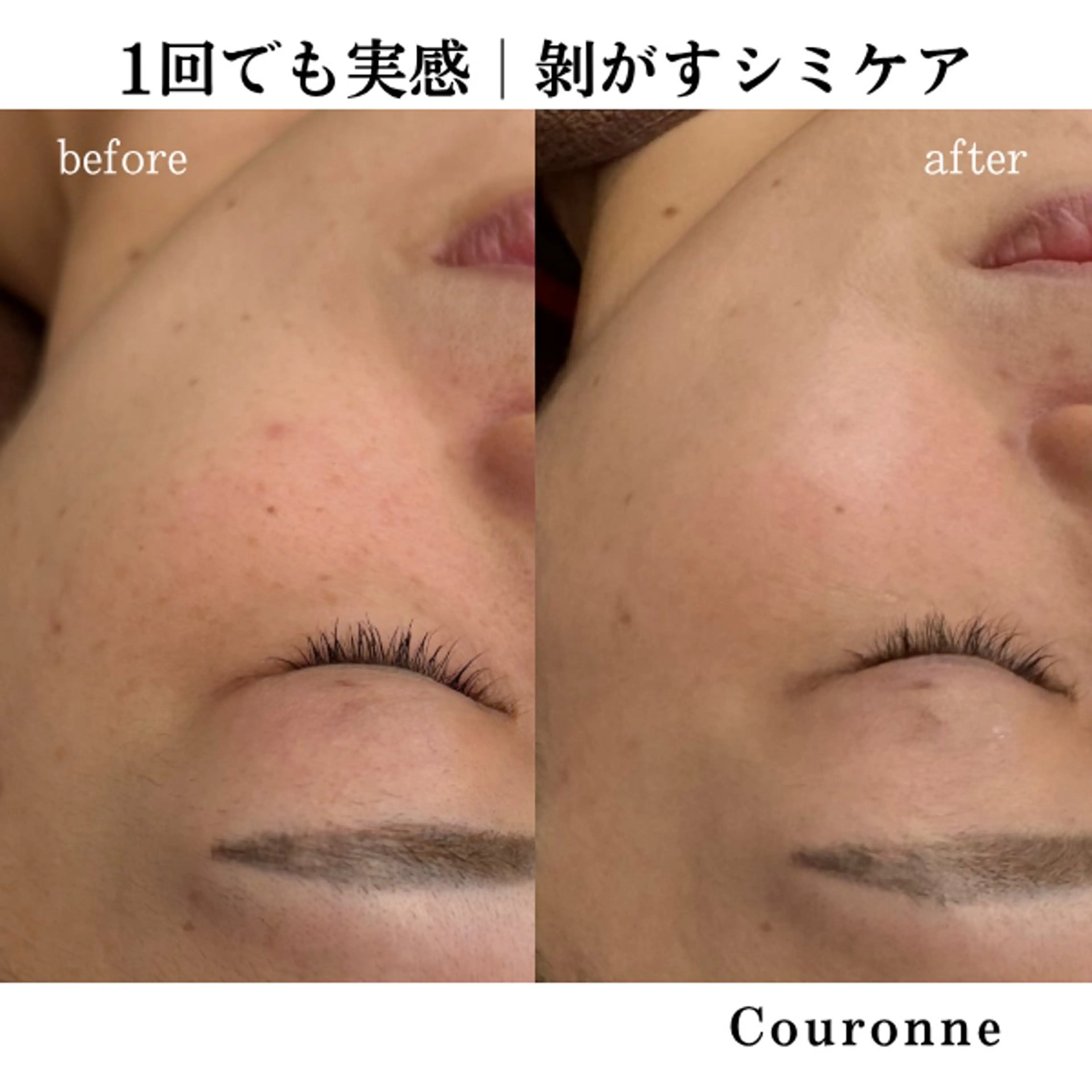 エステ シミ・毛穴ケア専門 クロヌYUKIのエステ・リラクイメージ