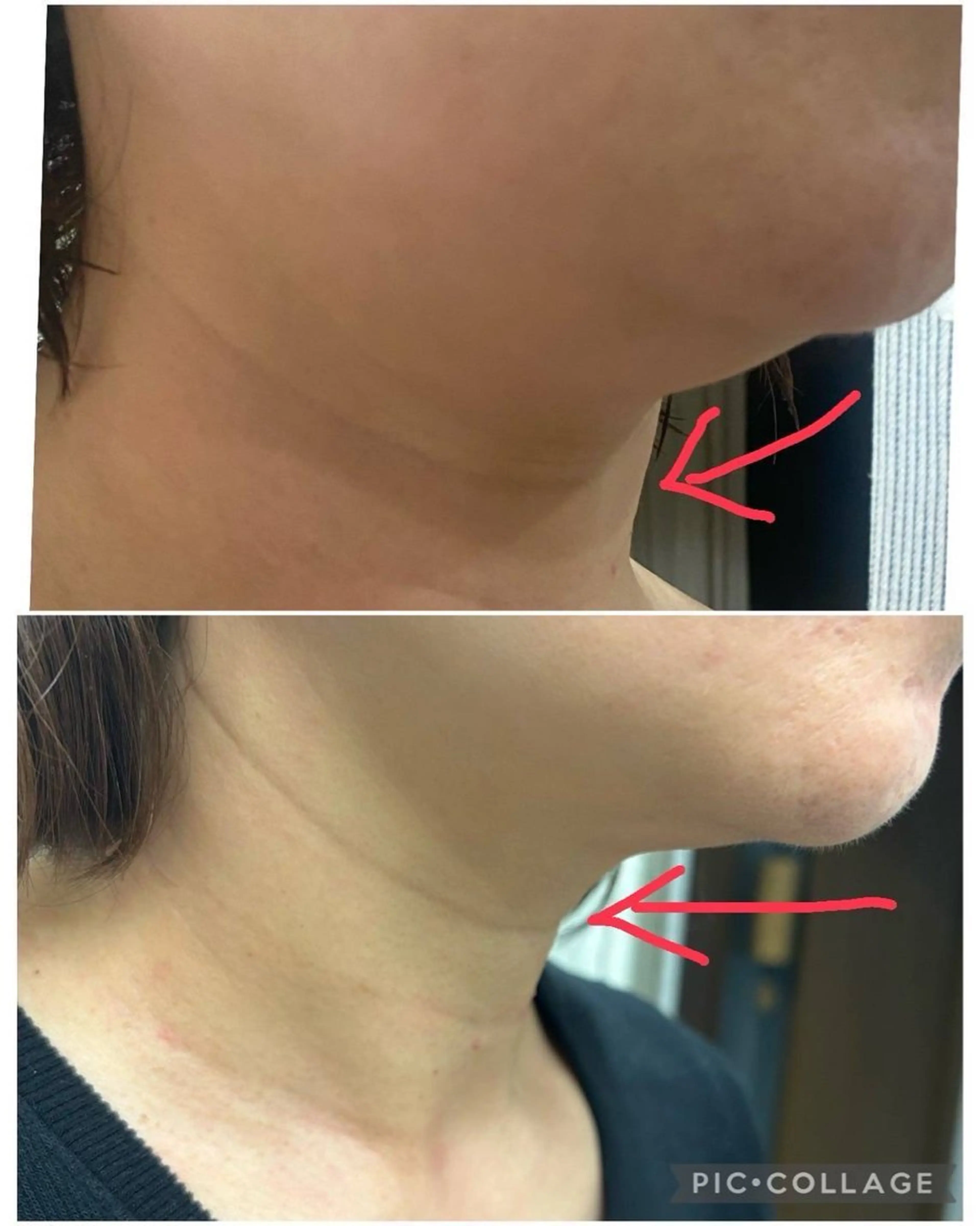 エステ ROR所属・ROR Nanaのネイルデザイン