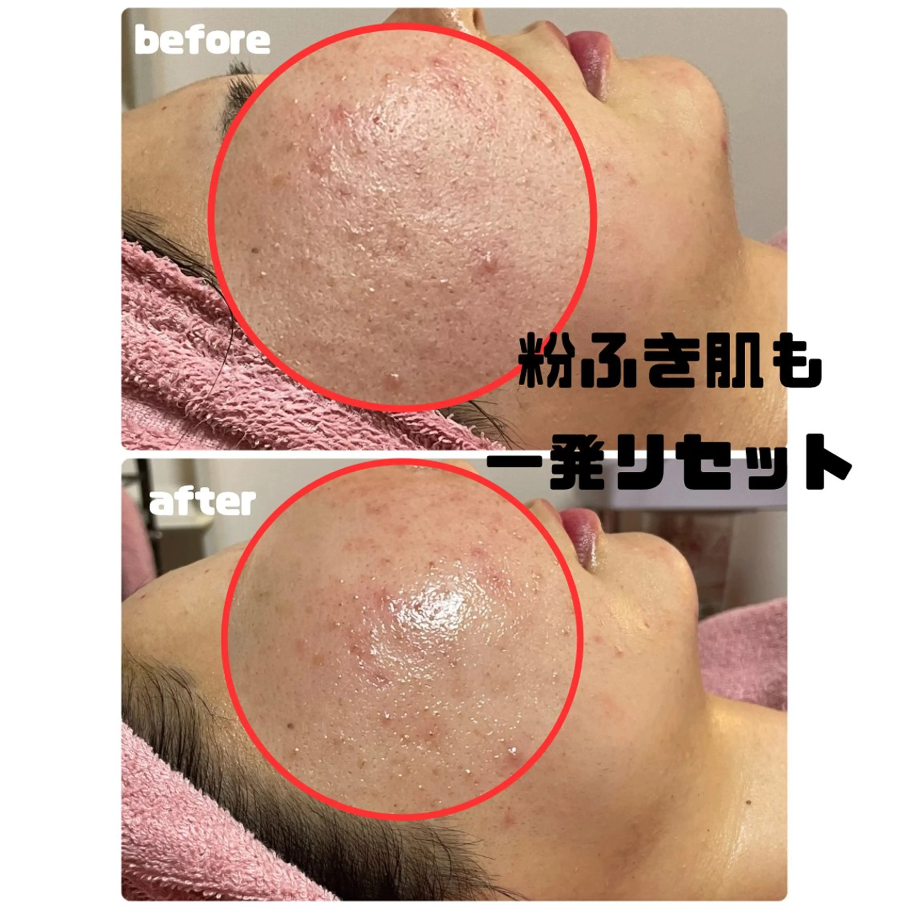 エステ 肌質改善専門店/絹々(きぬ)所属・心満たされる ハーブピーリング絹々のエステ・リラクイメージ