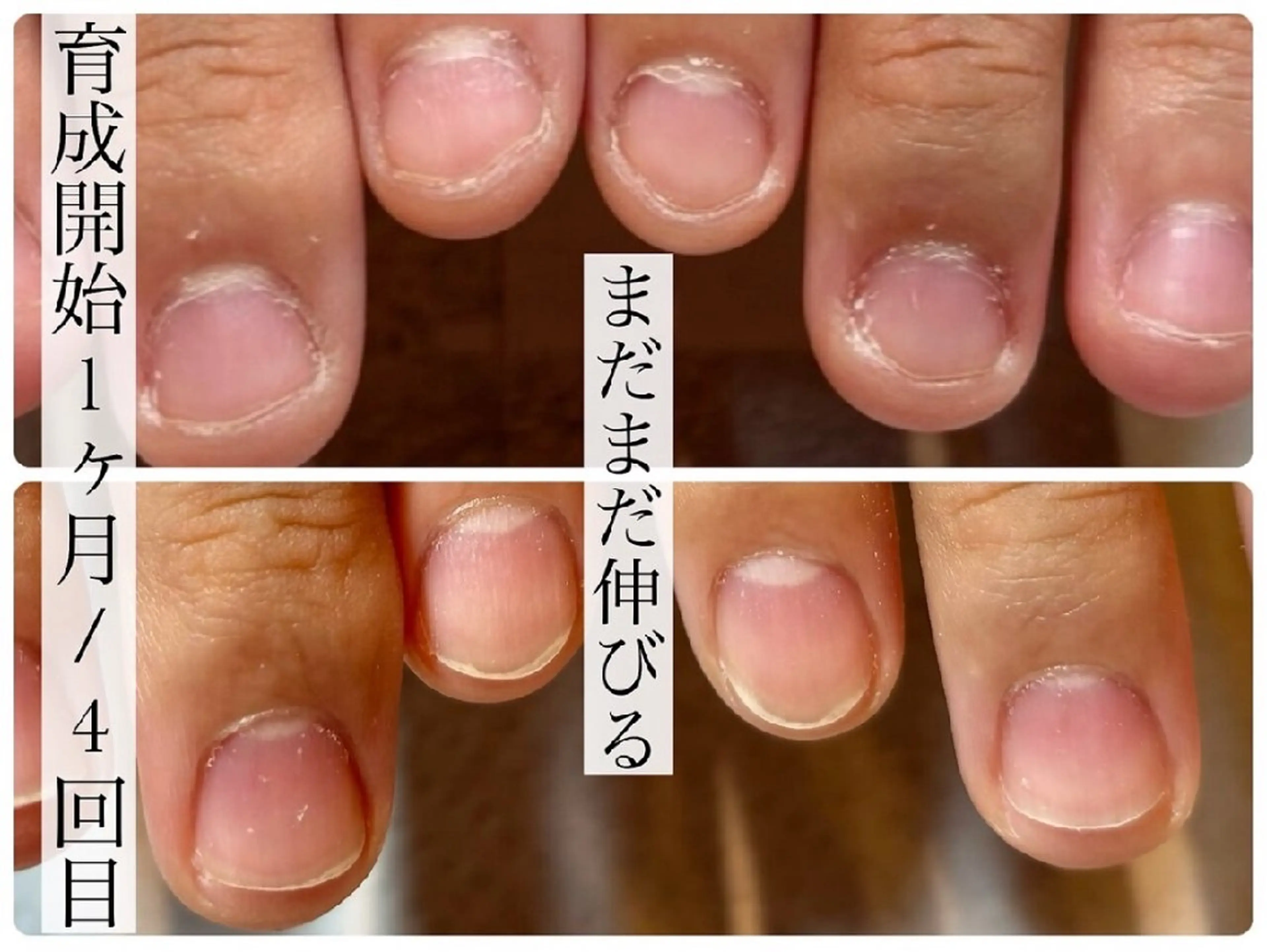 本格育爪モニター❁3回コース👐丁寧なカウンセリング付✨️の写真