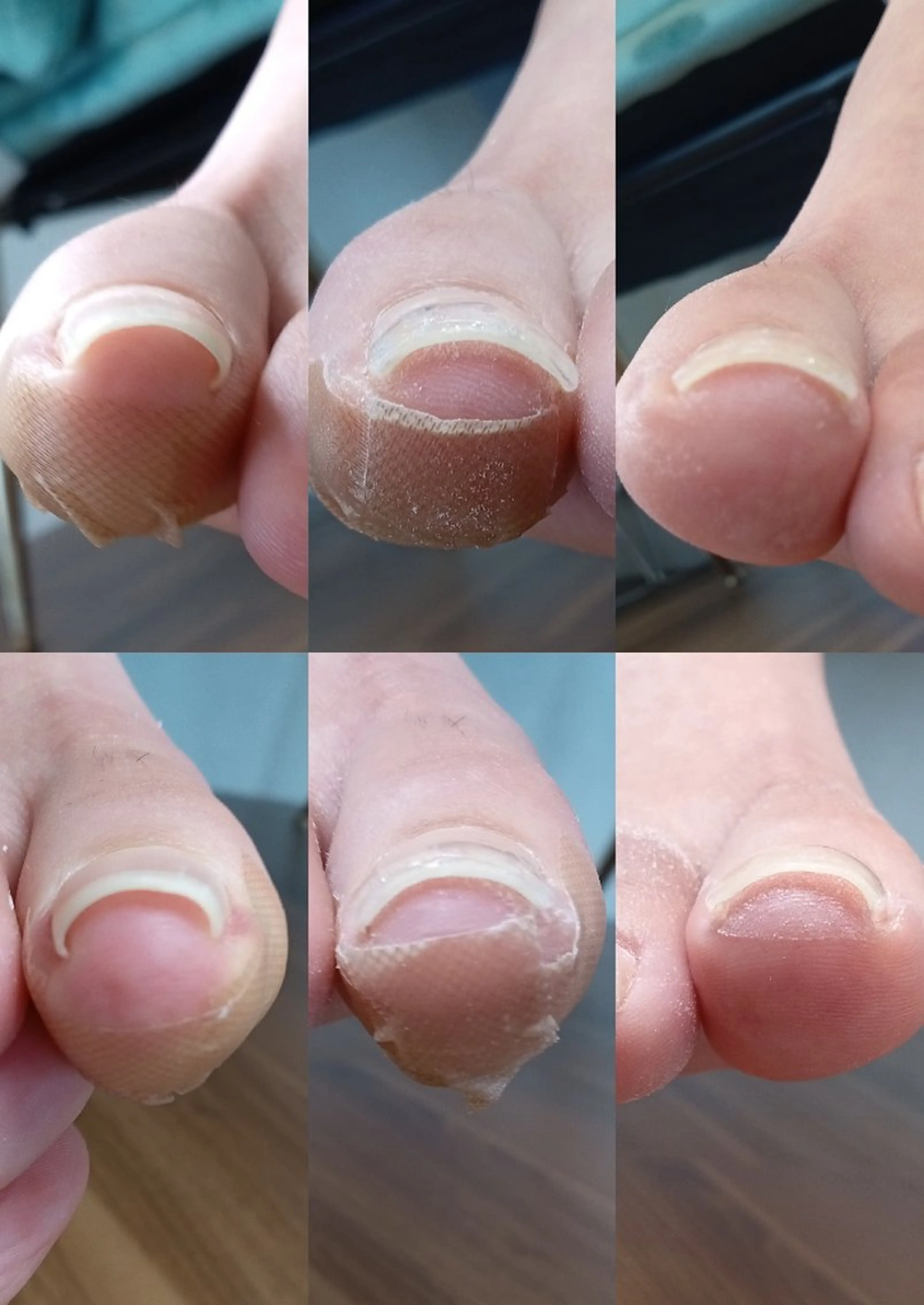 ネイル その他 フットケアルーム ~KaPilina~のネイルデザイン