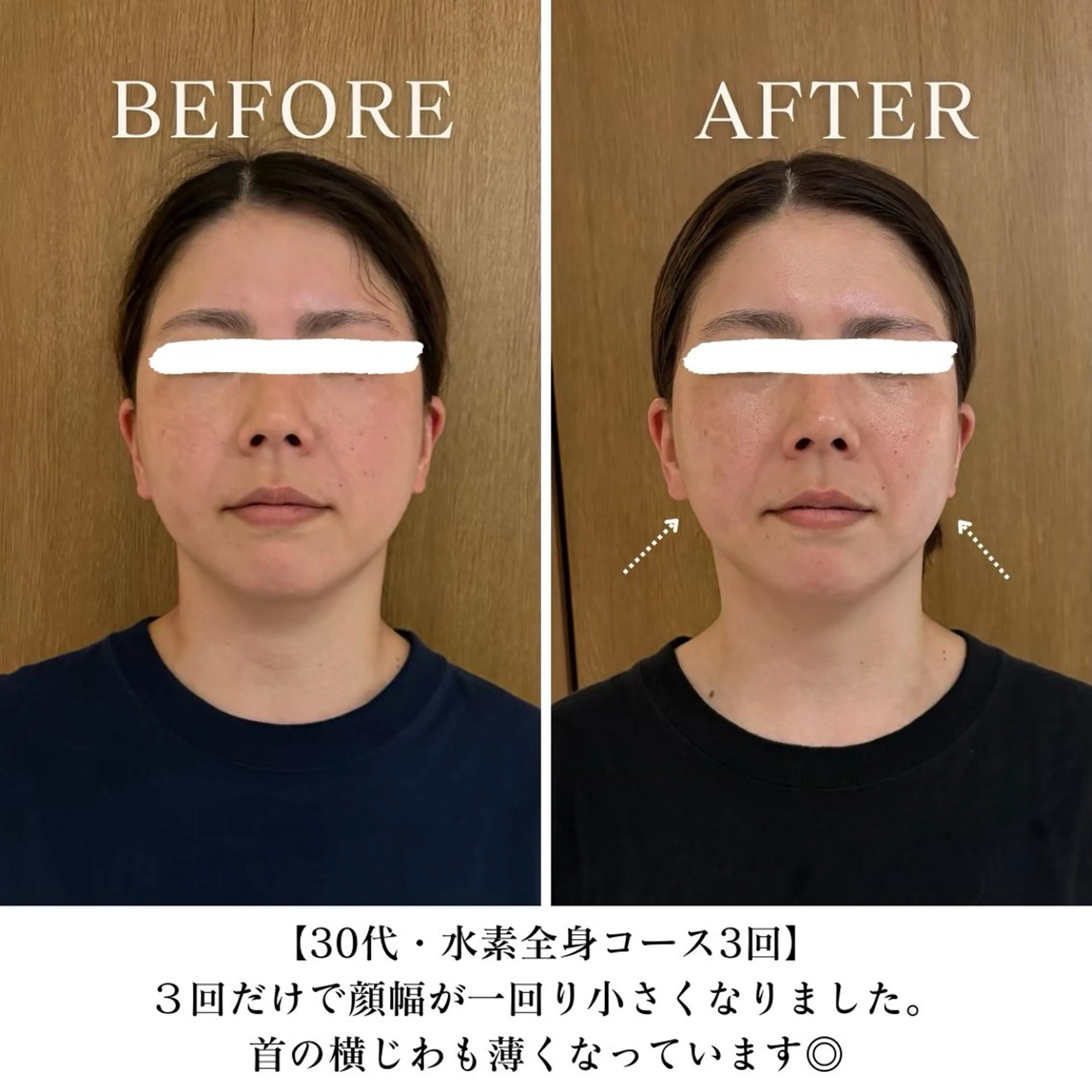 エステ リラク 【三軒茶屋/下馬】 本格痩身・よもぎ蒸しのその他イメージ