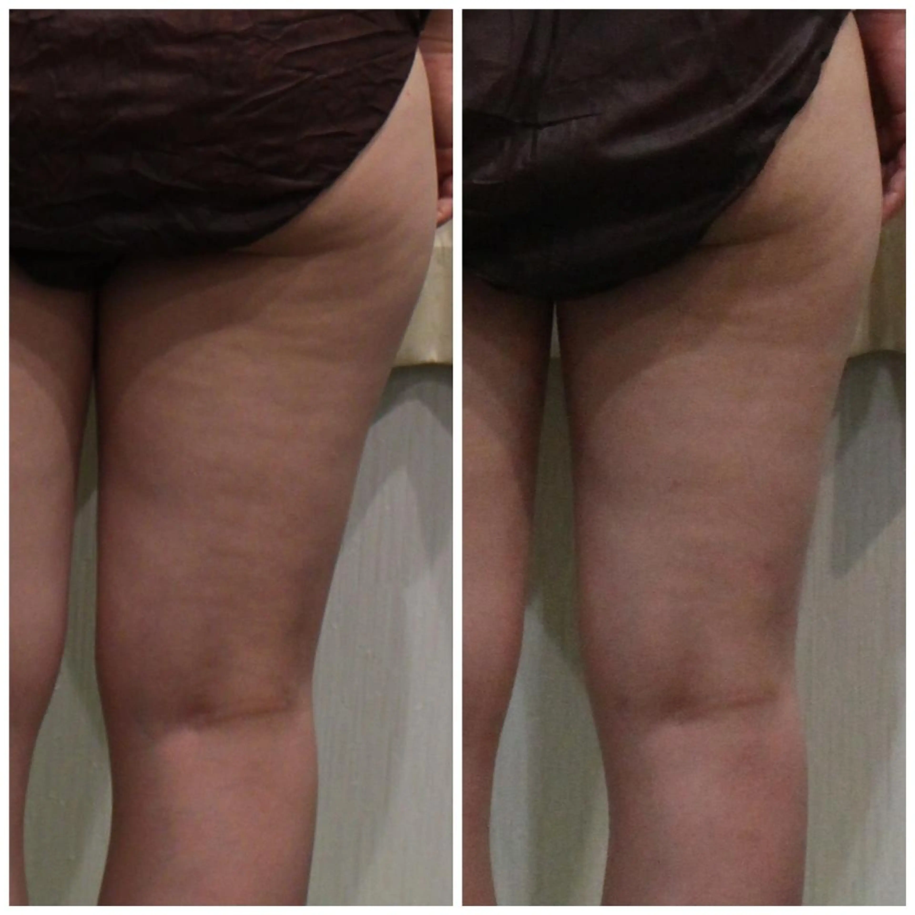 ANRIRE (アンリール)のエステ・リラクイメージ