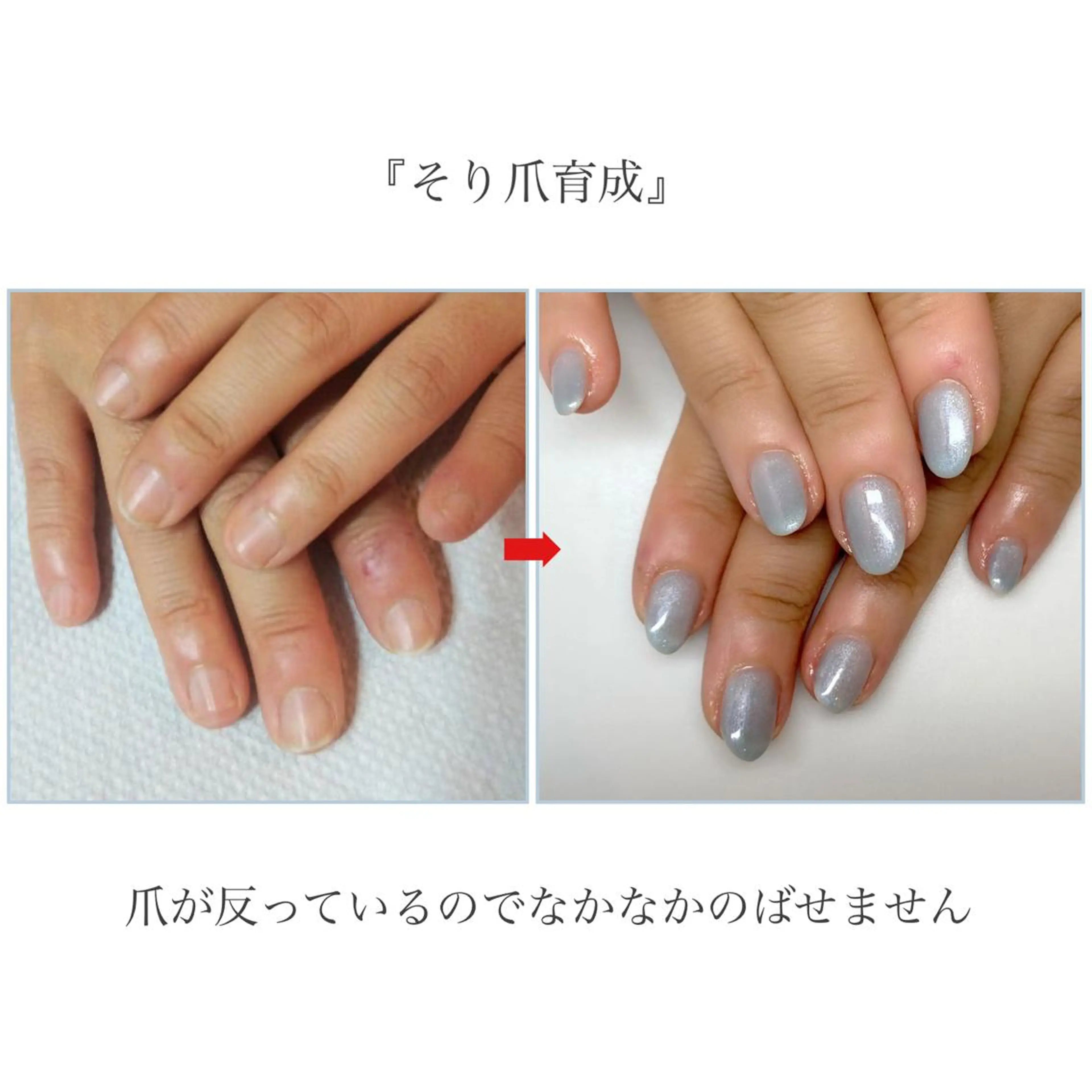 ネイル ネイルサロン アリュームのネイルデザイン