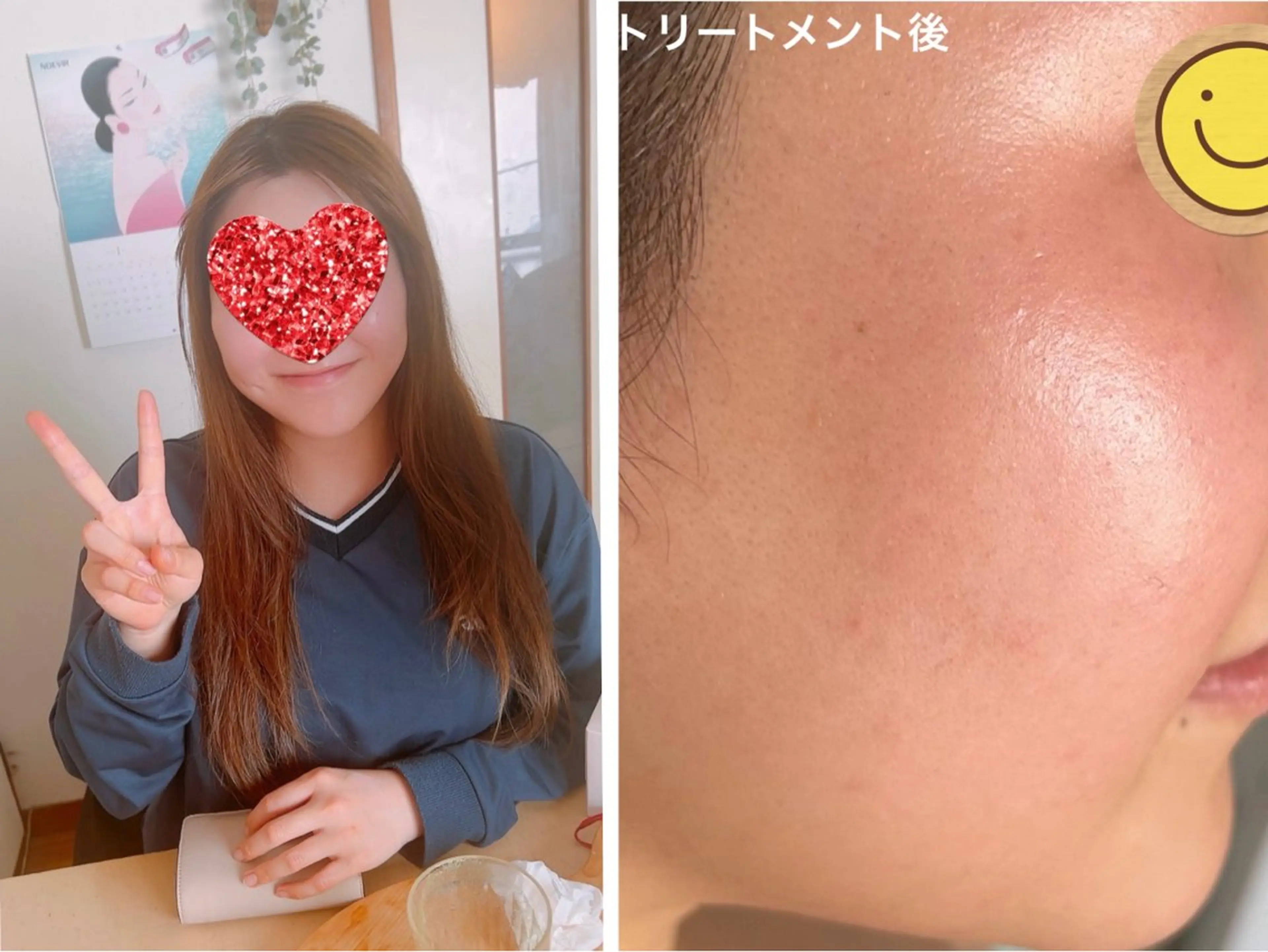 ノエビアビューティー セレンディピティのエステ・リラクイメージ