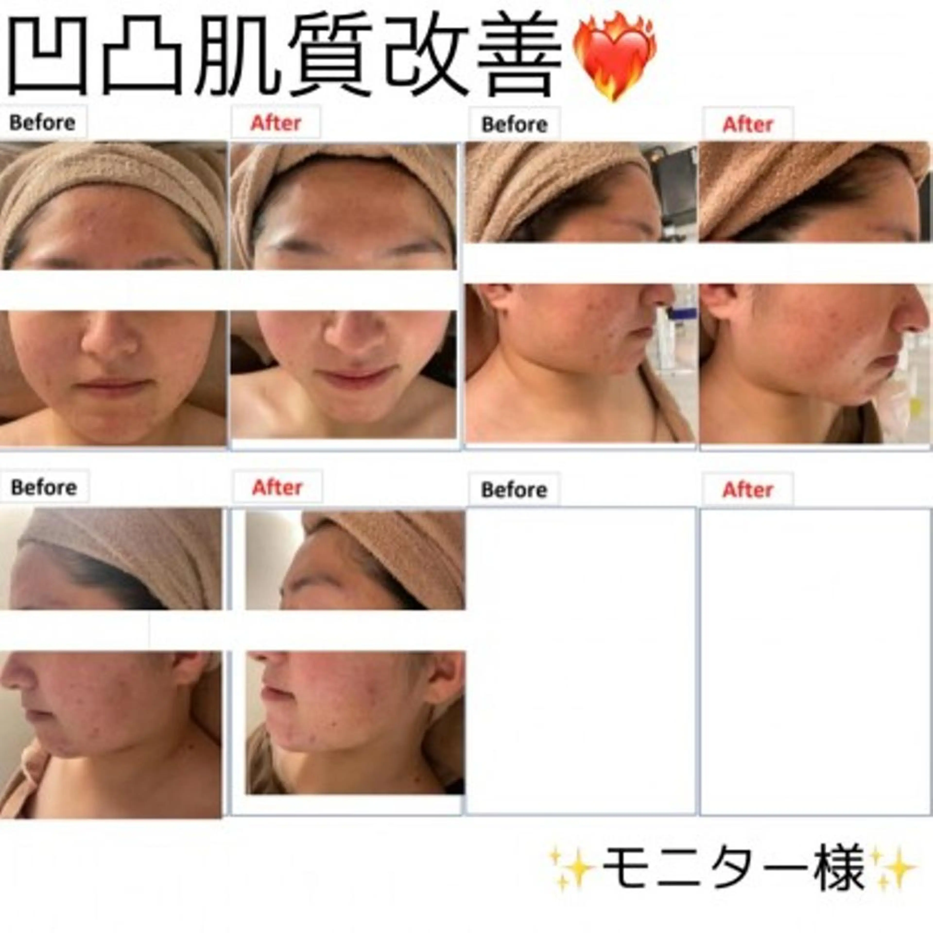 バスト専門店 RAYVIS🌺髙田のエステ・リラクイメージ