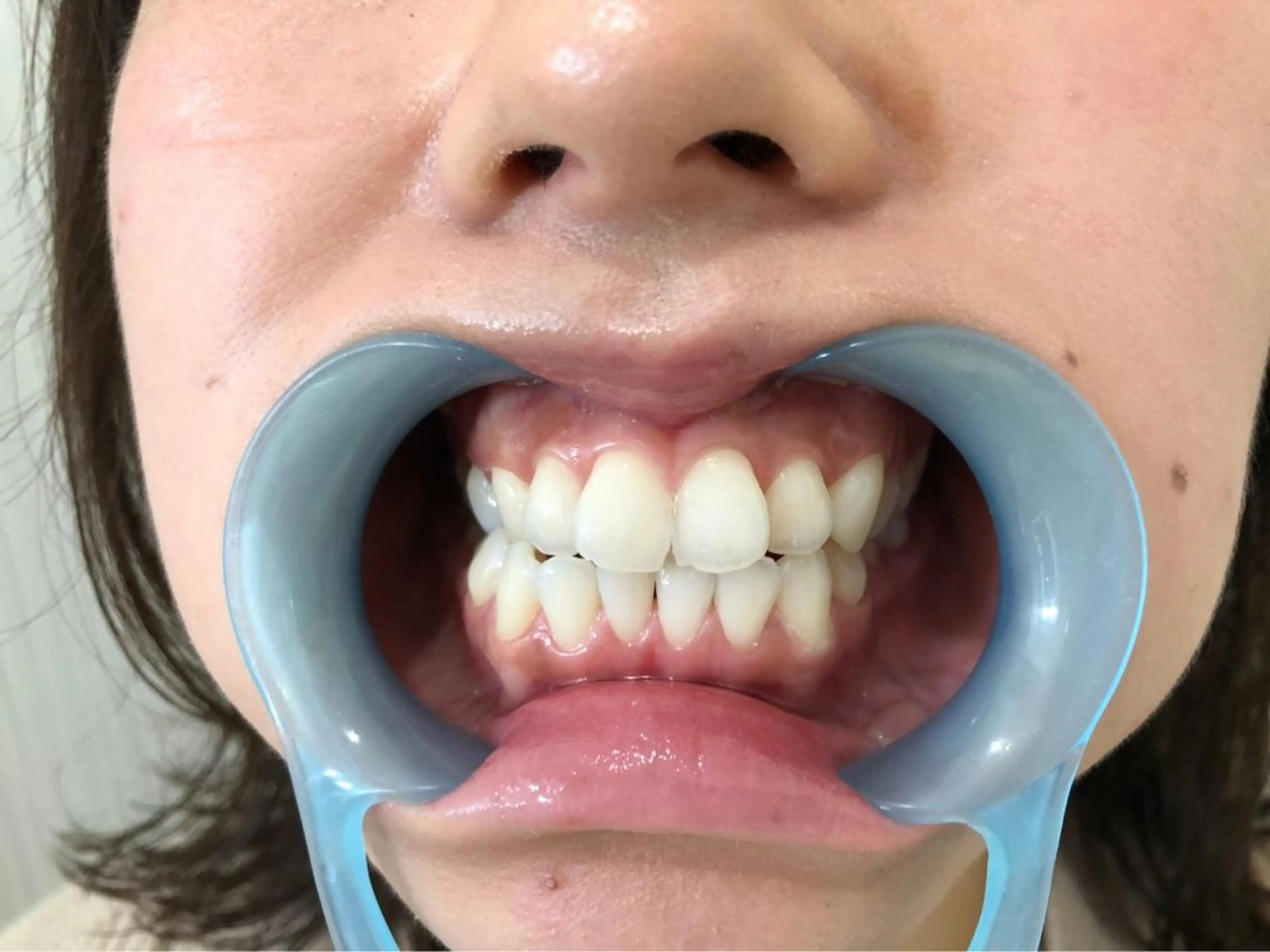 その他 セルフホワイトニングサロン　ラヴィアン所属・ホワイトニングサロン La vie enのその他イメージ