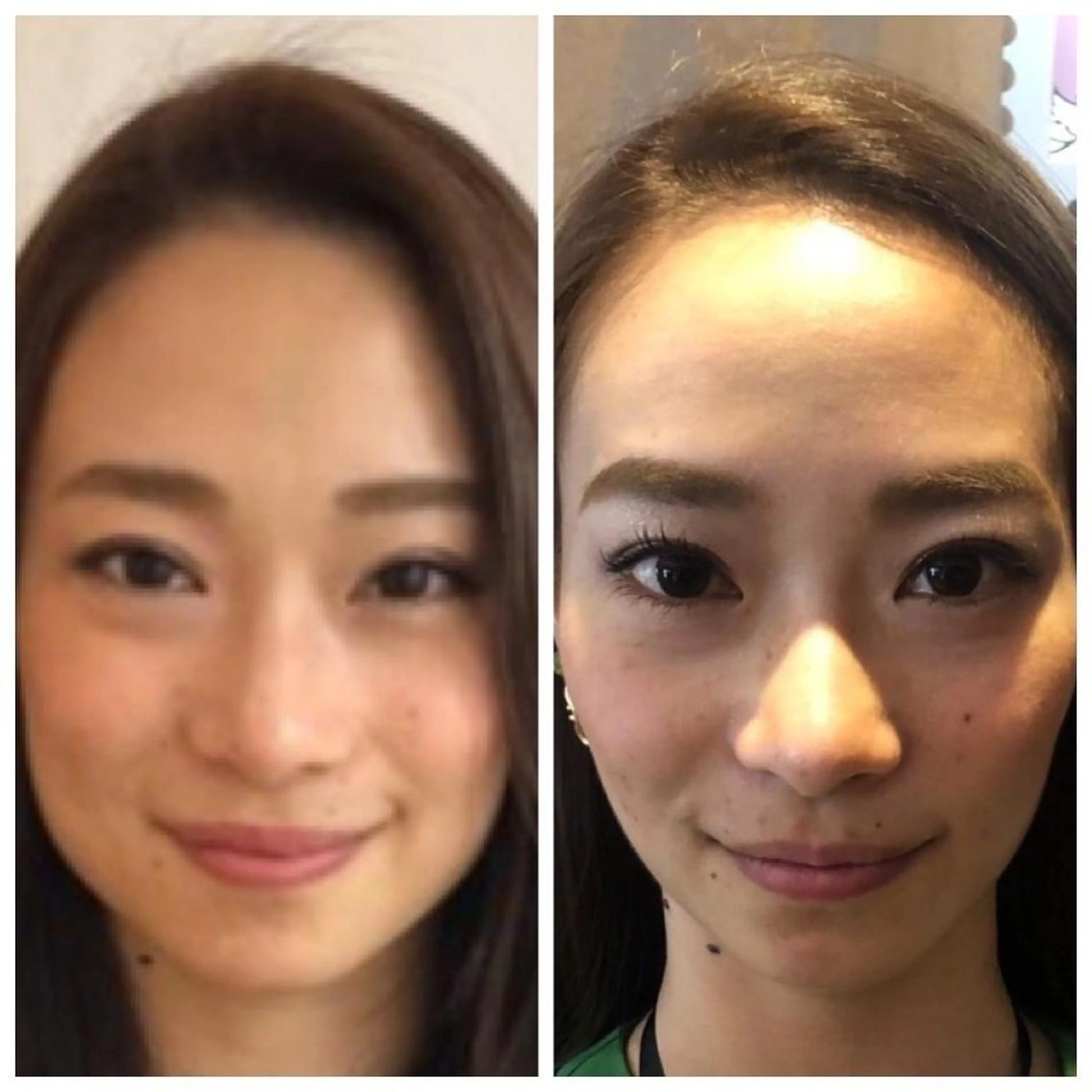 💙美容鍼💙美顔矯 正🧡Brilo🧡のエステ・リラクイメージ