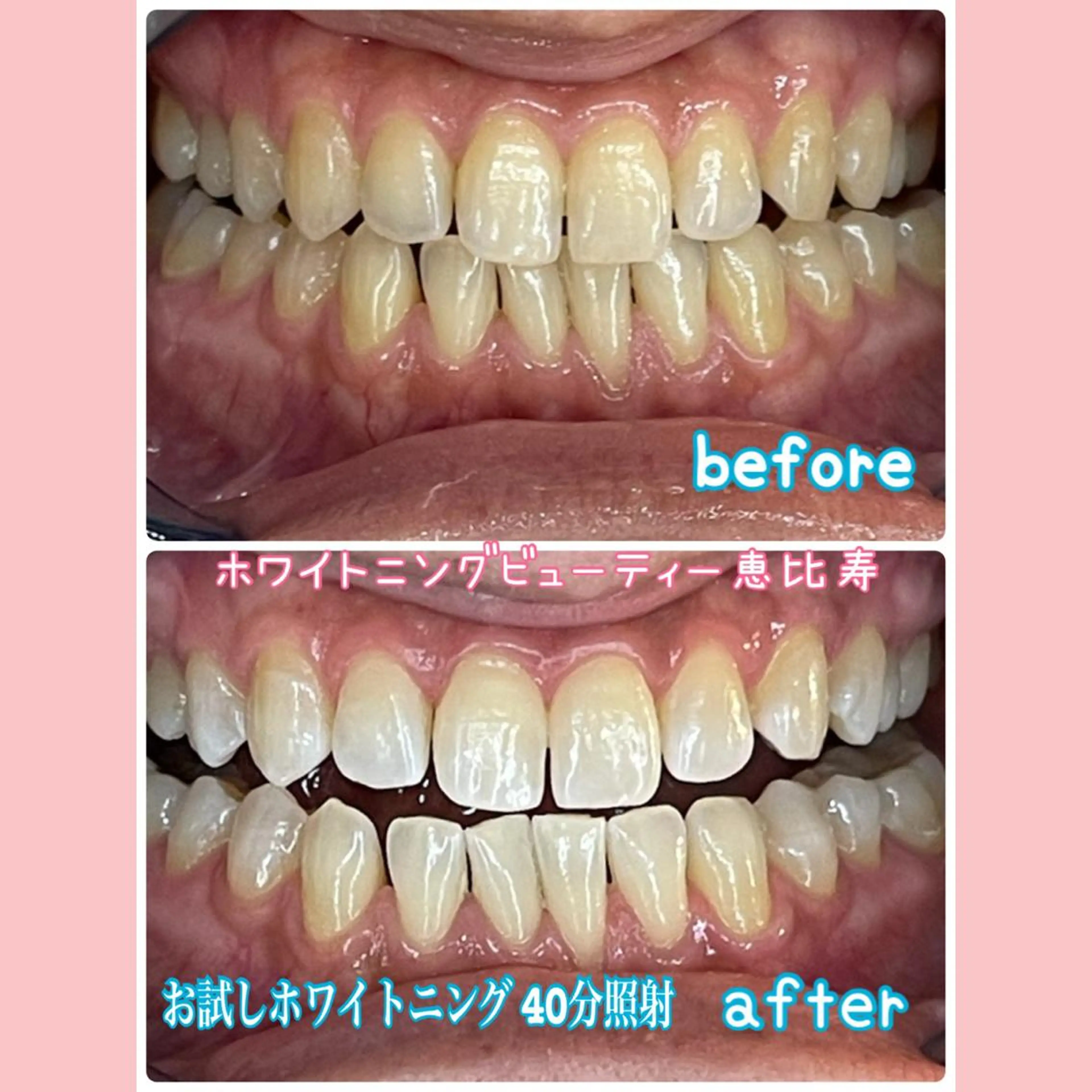 EMINAL恵比寿 HITOMIのエステ・リラクイメージ