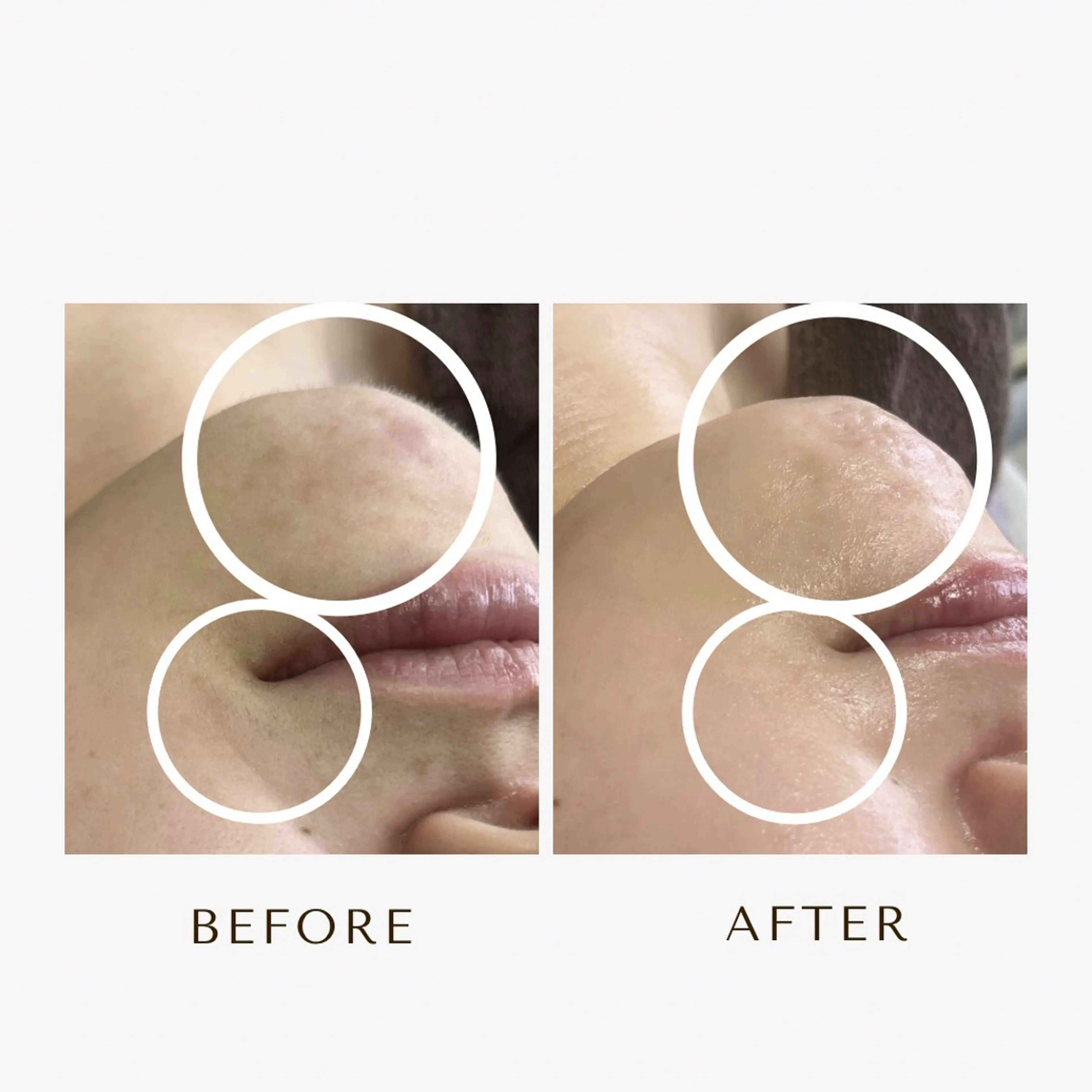 脱毛 1st｜フェイシャル エステ専門店のエステ・リラクイメージ