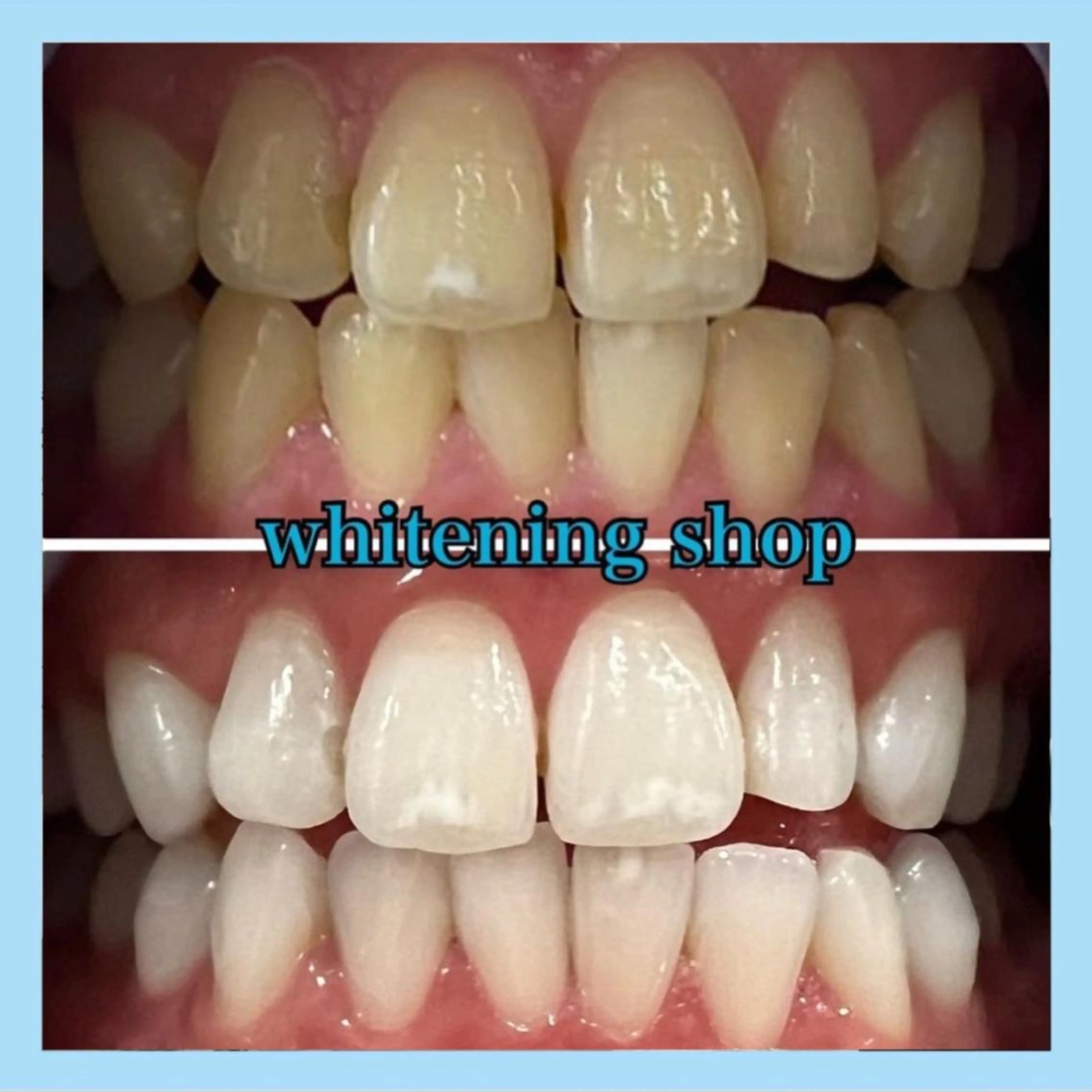 ホワイトニング ショップ千葉店のその他イメージ