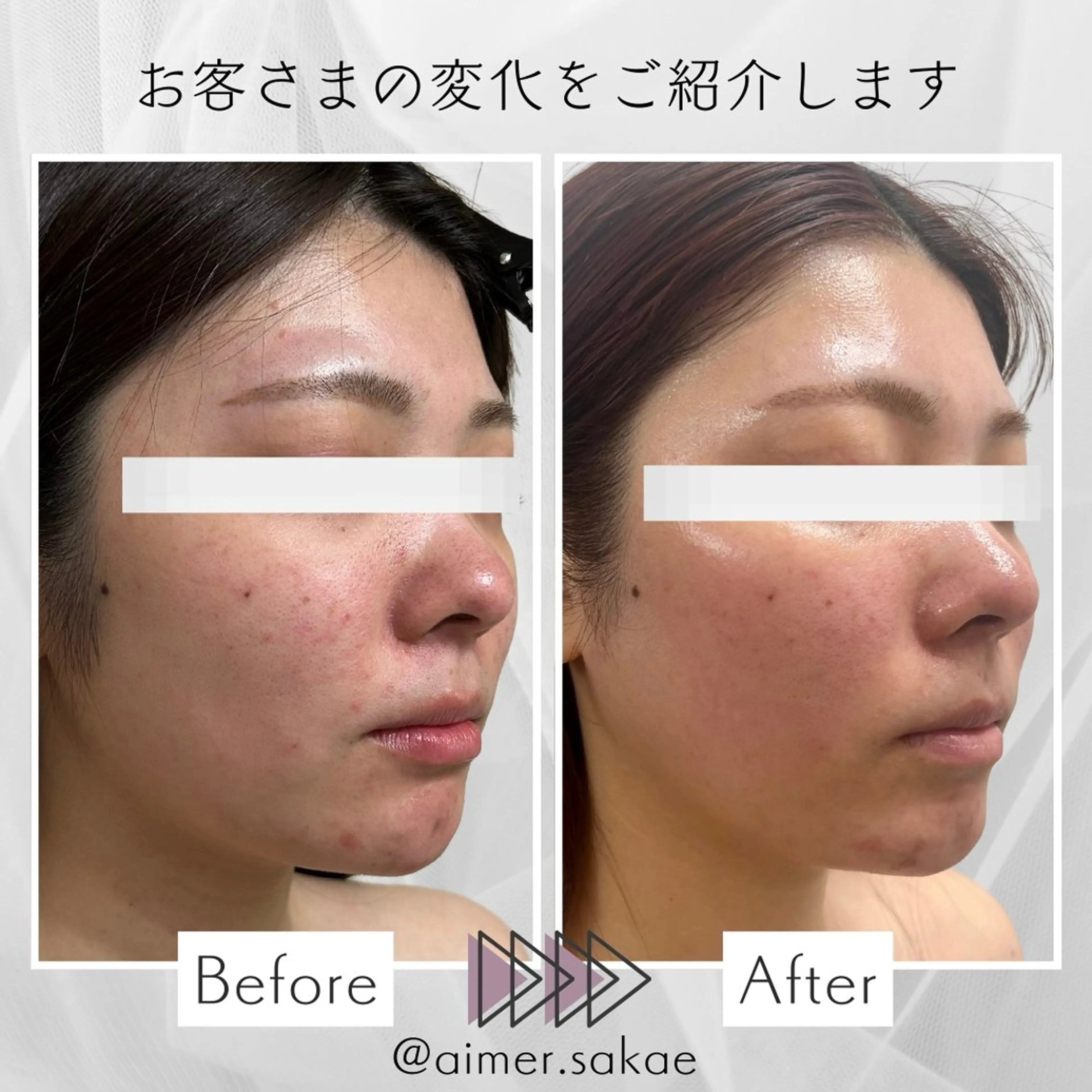 aimer 佐々木のエステ・リラクイメージ