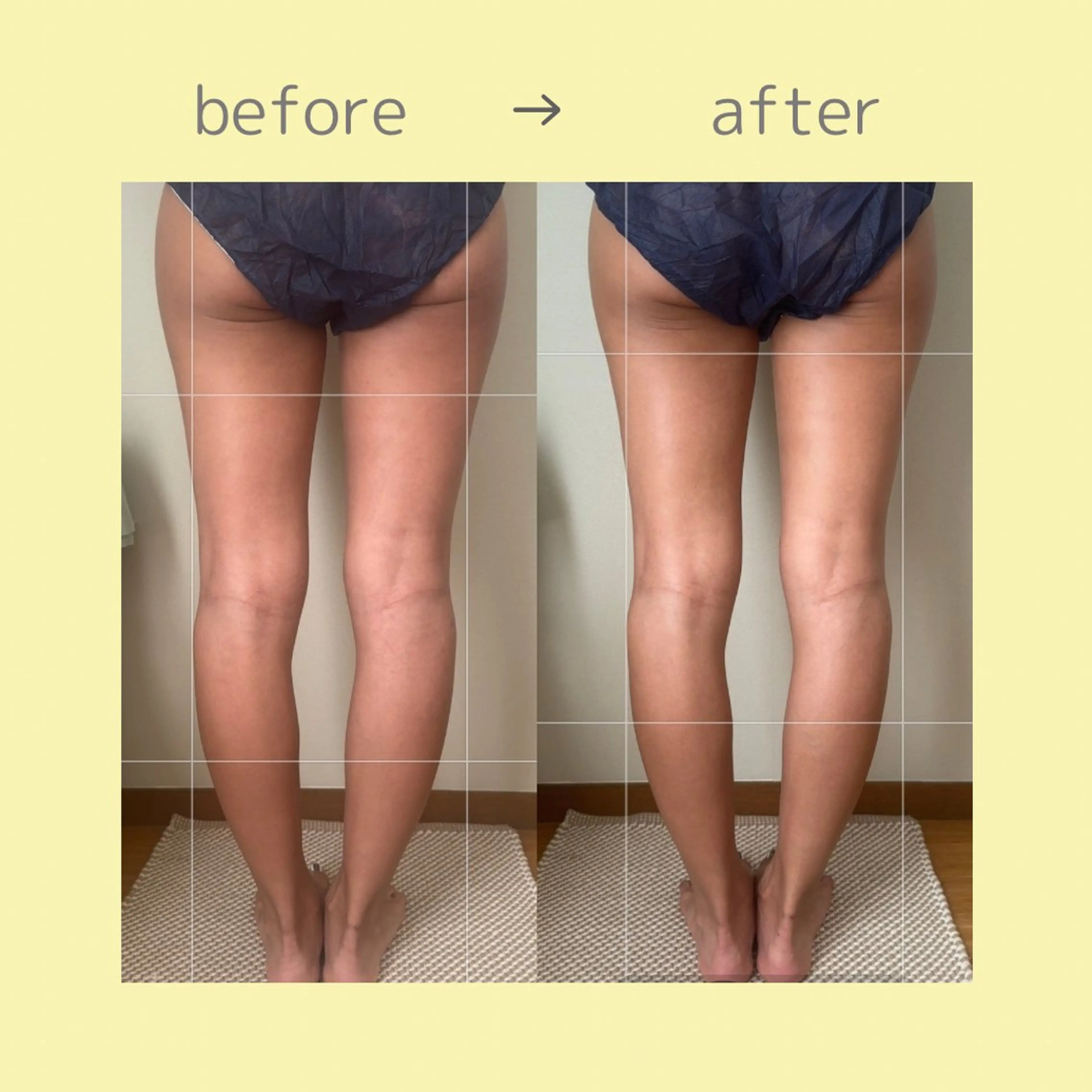 リラクゼーションスパ　ひのき所属・spaHINOKI 【女性専用】のエステ・リラクイメージ