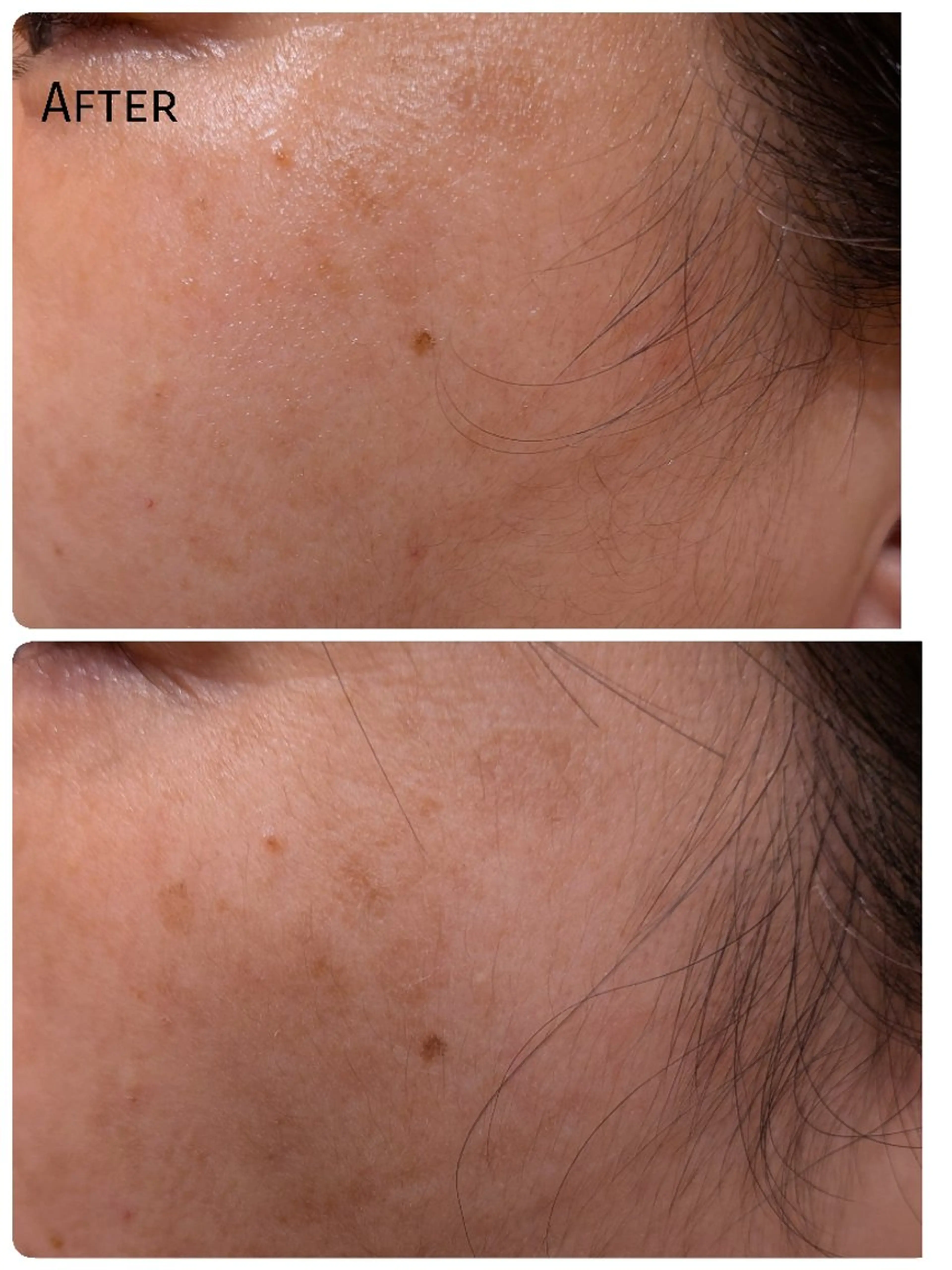 A.Nails salonのネイルデザイン