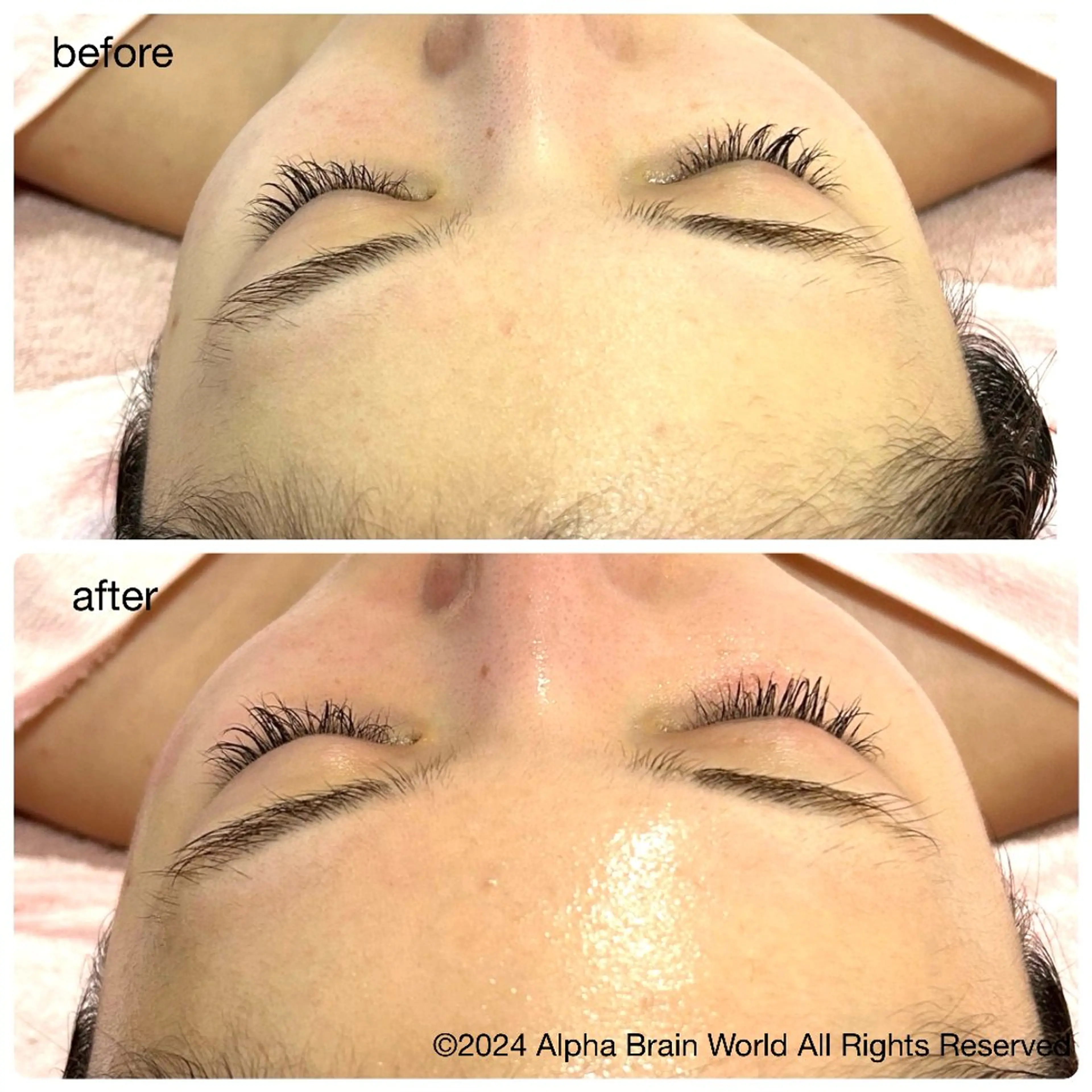 脱毛/美肌【皮膚科看 護師経営】ラベニールのエステ・リラクイメージ