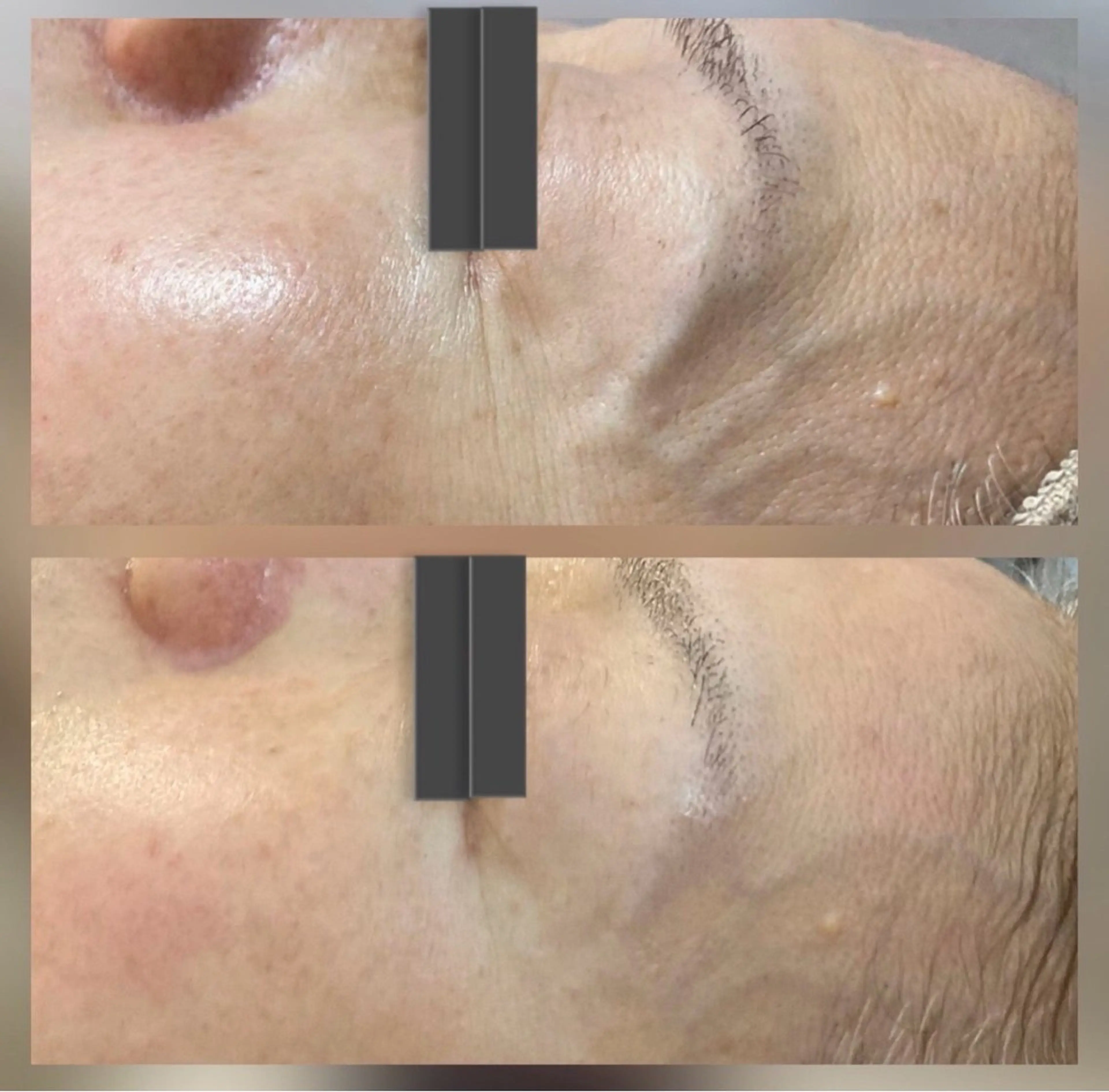 エステ 【ANEMONA】 Kyokoのネイルデザイン