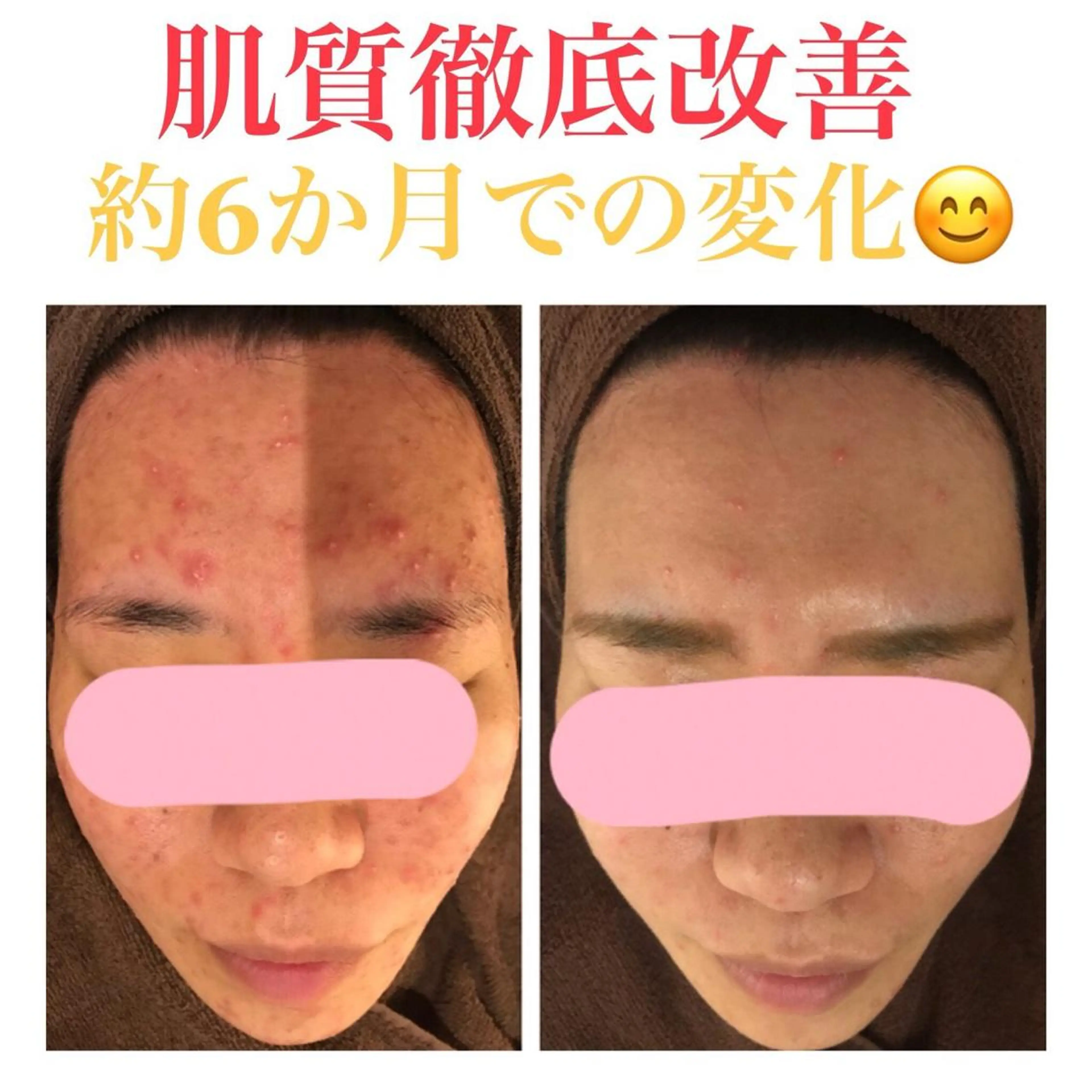 ミディアム カラー パーマ ヘアアレンジ メンズ キッズ ネイル マツエク・マツパ ニキビ・肌質改善専門 ♡人生が変わるサロンのエステ・リラクイメージ