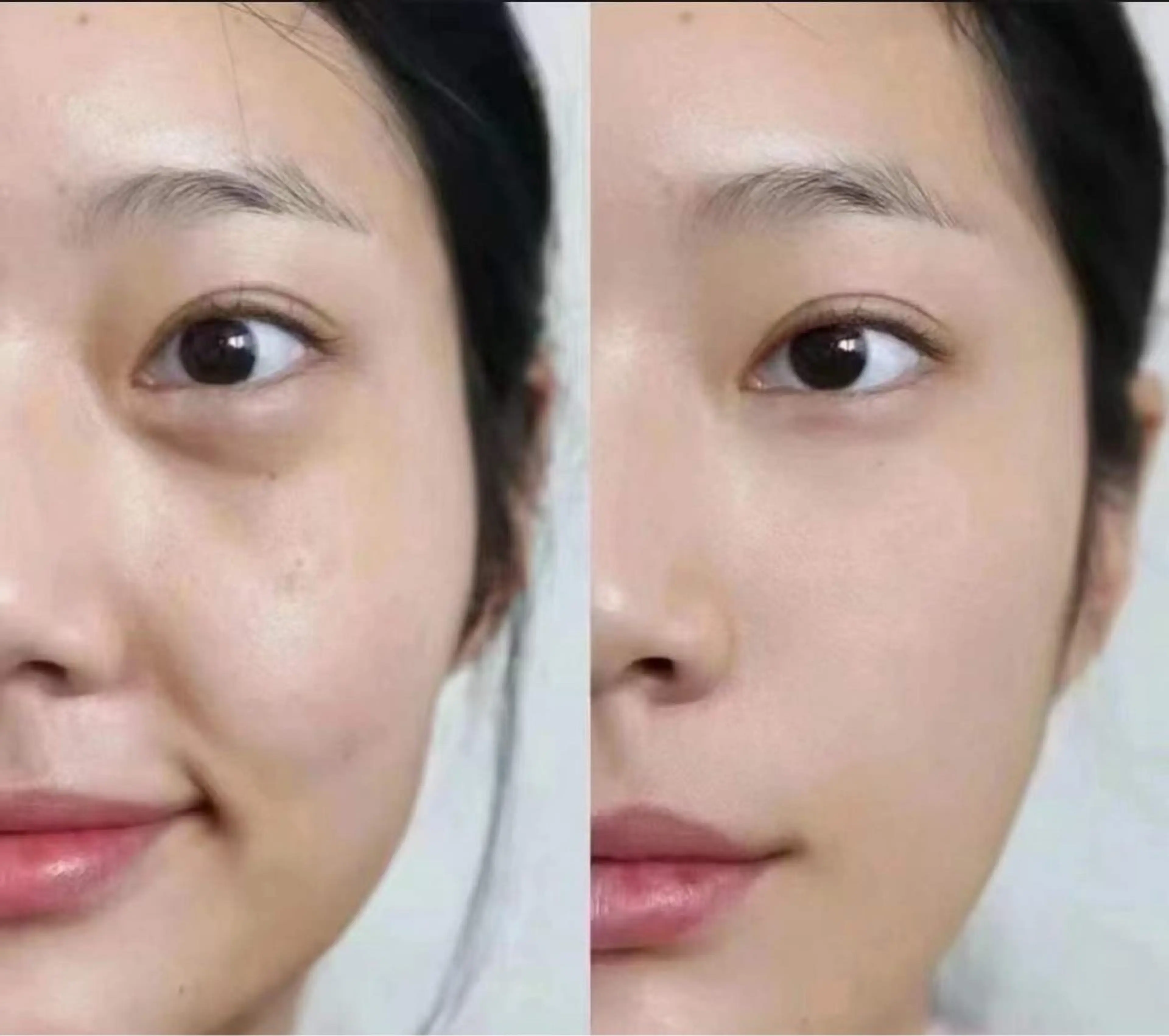 マツエク・マツパ エステ aliaハイフ&水光ジェットサロン所属・aliaハーブ水光店 エステティシャン募集のエステ・リラクイメージ