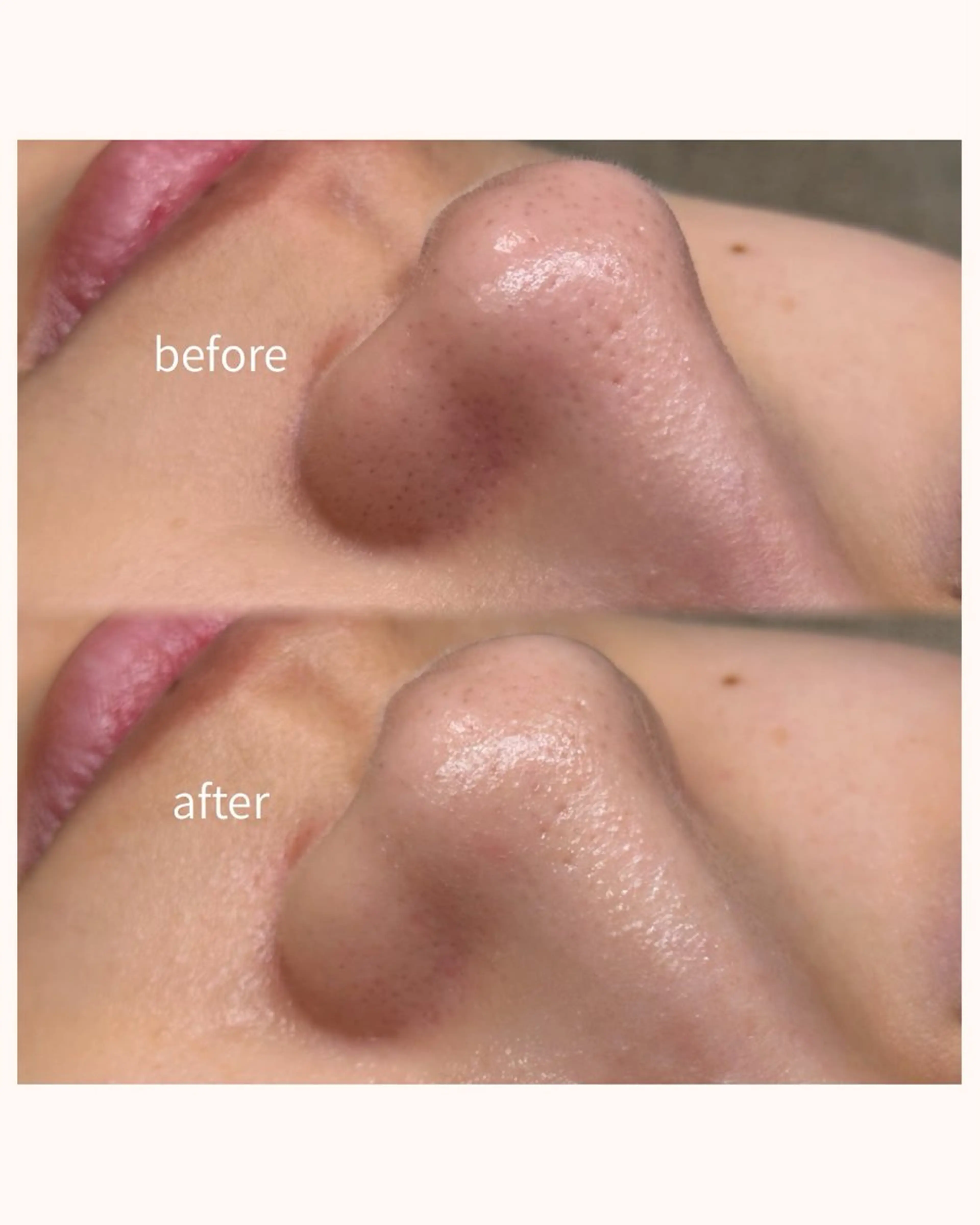 エステ 毛穴と脱毛のお店 "Lea" 壷林のエステ・リラクイメージ