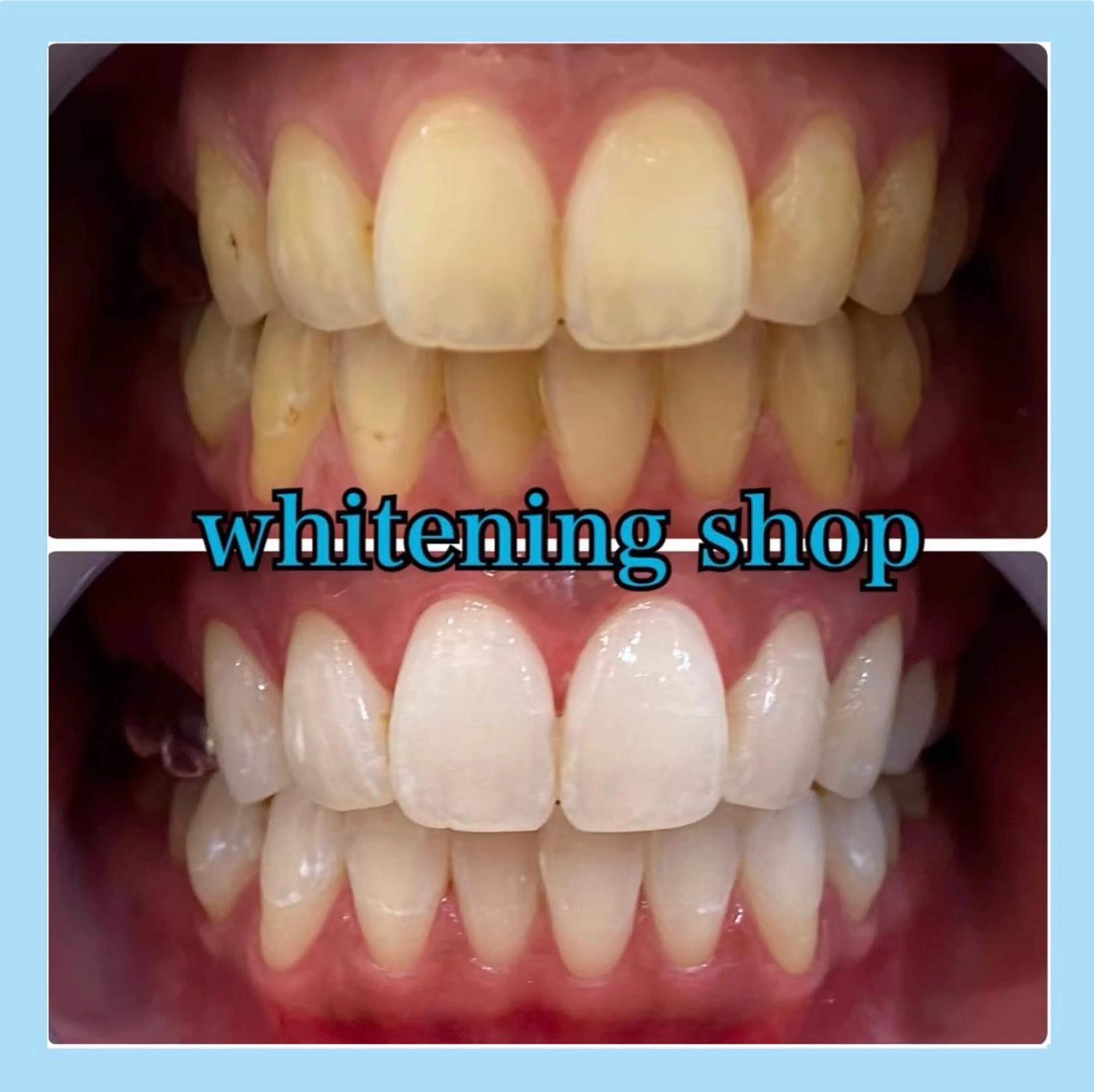 ホワイトニング ショップ千葉店のその他イメージ